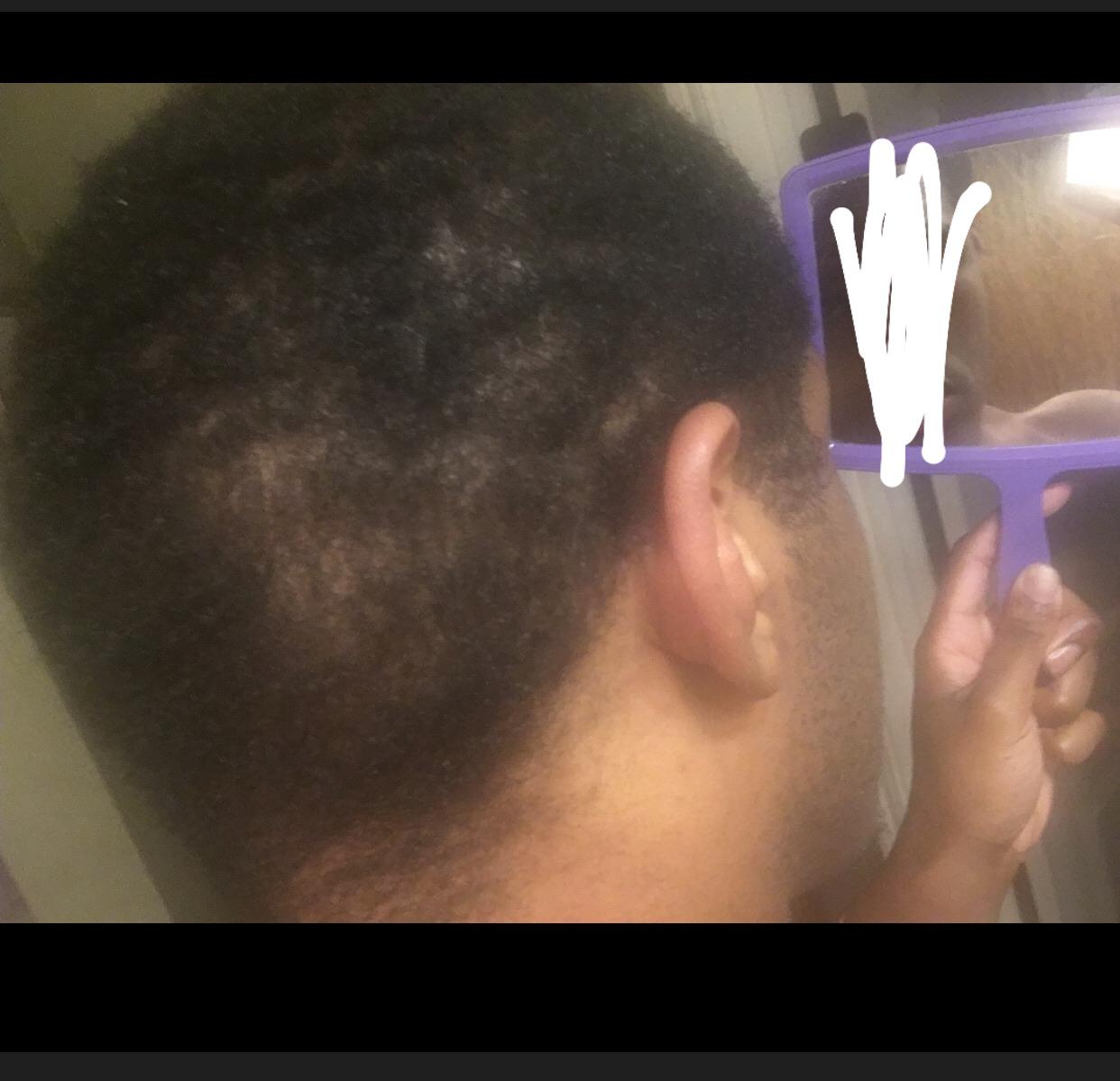 This is the back of my hair. It grows so much slower than the rest of