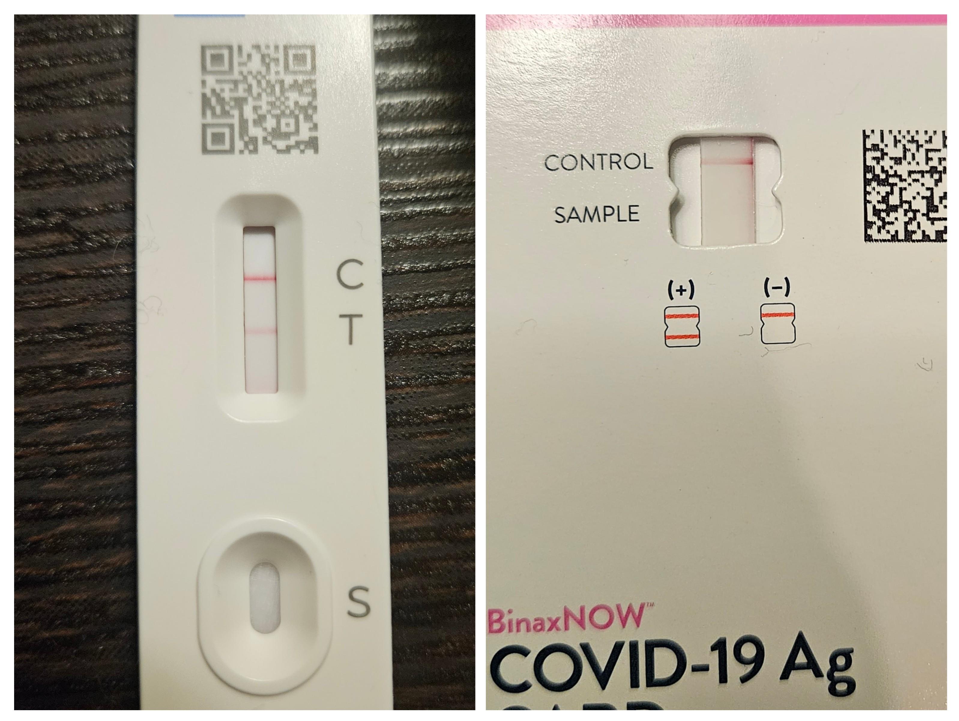 Should I presume positive? Tested with expired and non expired test r