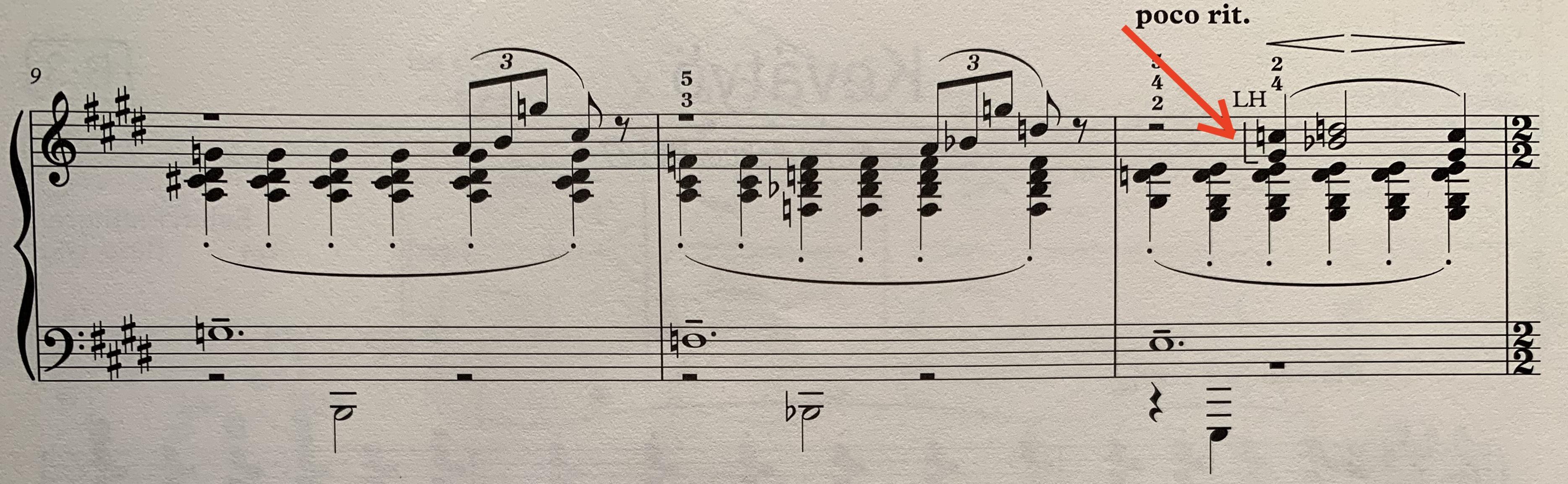 What does this half bracket under the "Left Hand (LH)" notation in the