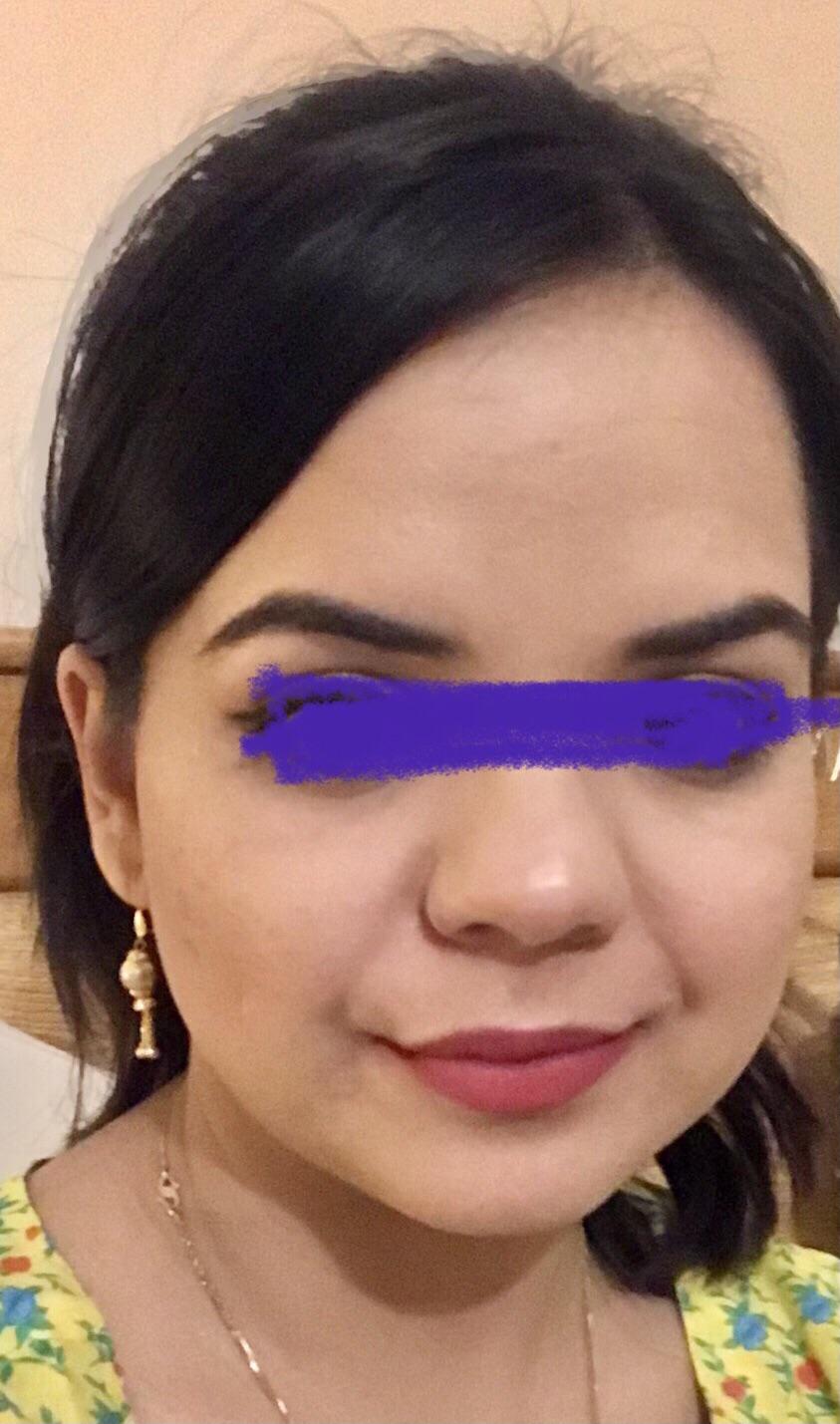 Does anyone have experience of getting surgery in Turkey? I’m looking