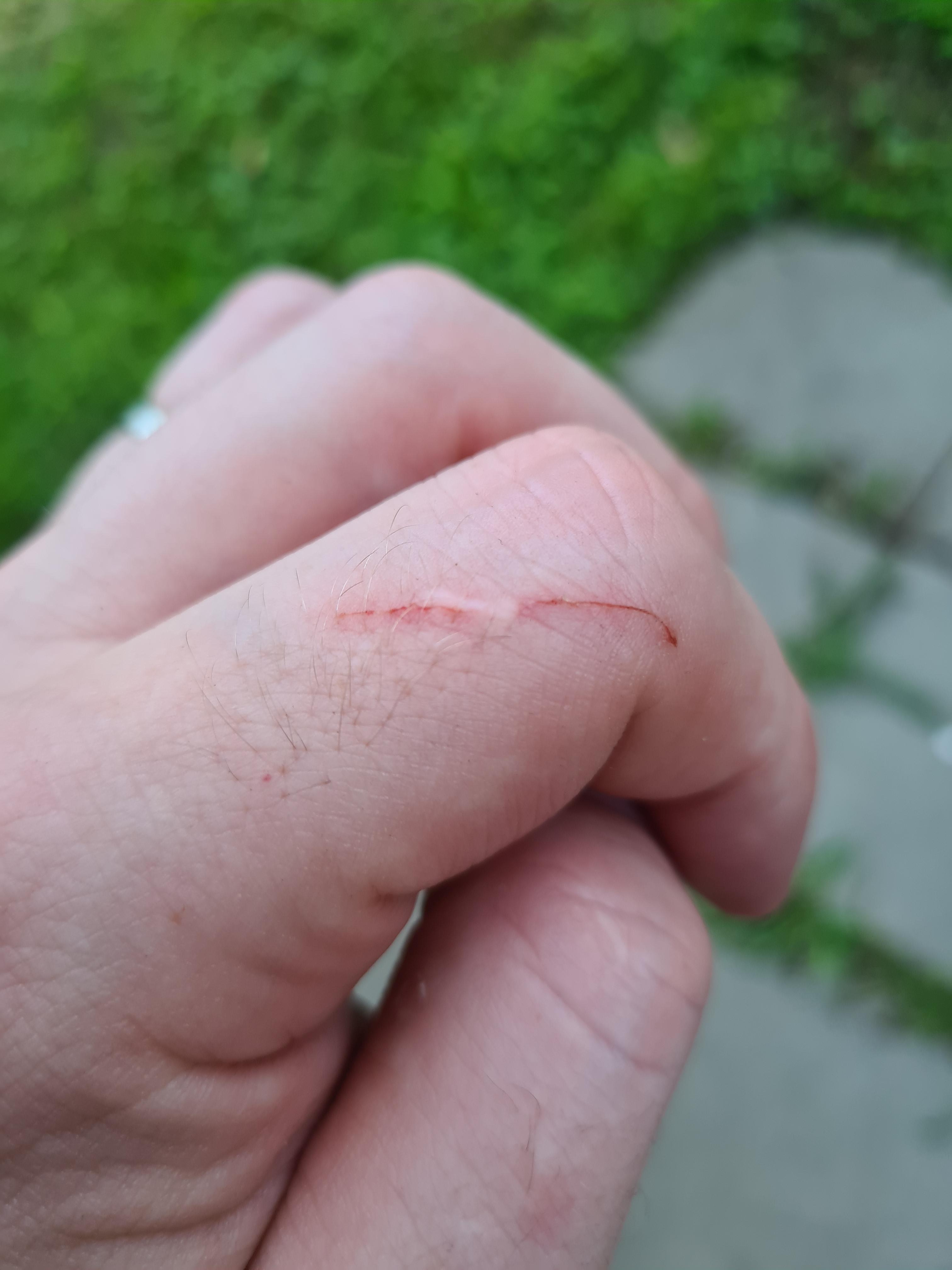 My scar from a cat scratch is immune to cat scratches mildlyinteresting