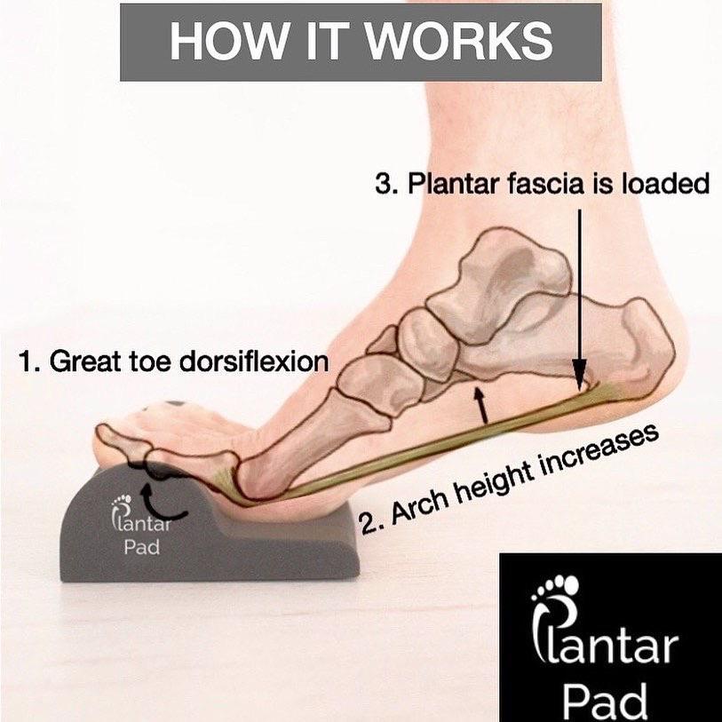 Check out the Plantar Pad, it’s based on a study done in 2015 which