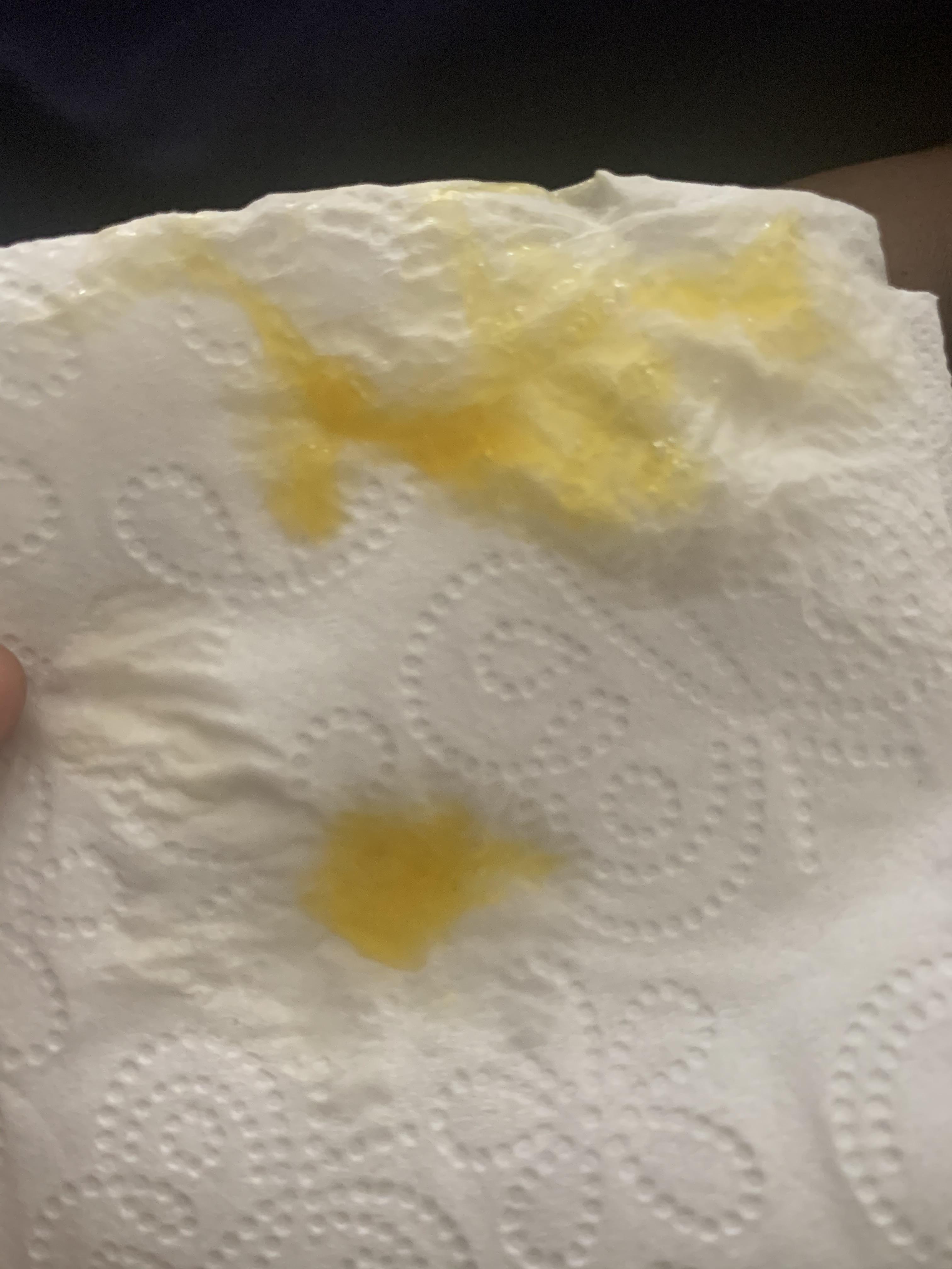 Recovered from a cold recently, I have had constant sinus pain and pain