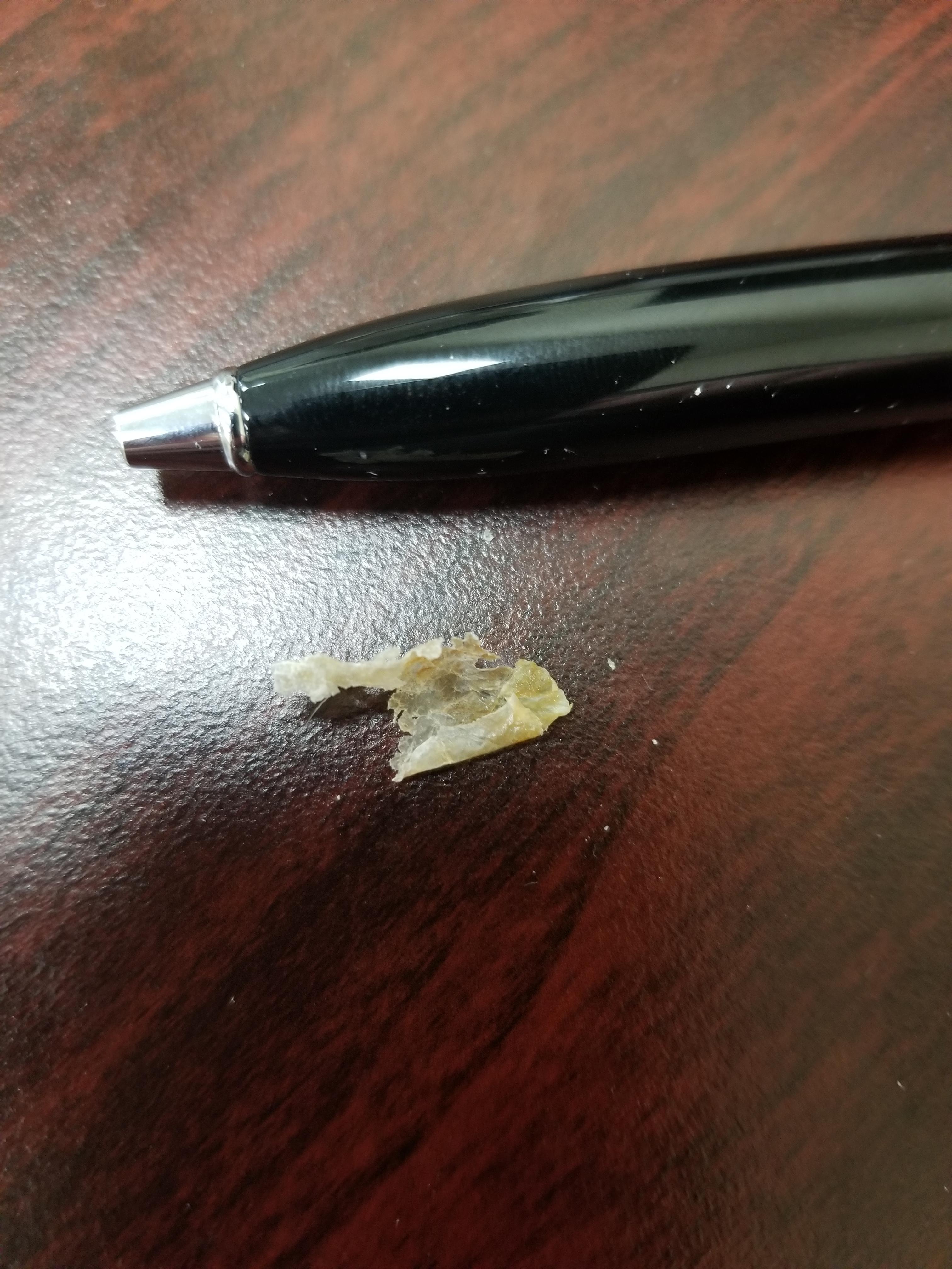 Ear was clogged with fluid for a few days. Today it was dry and itchy