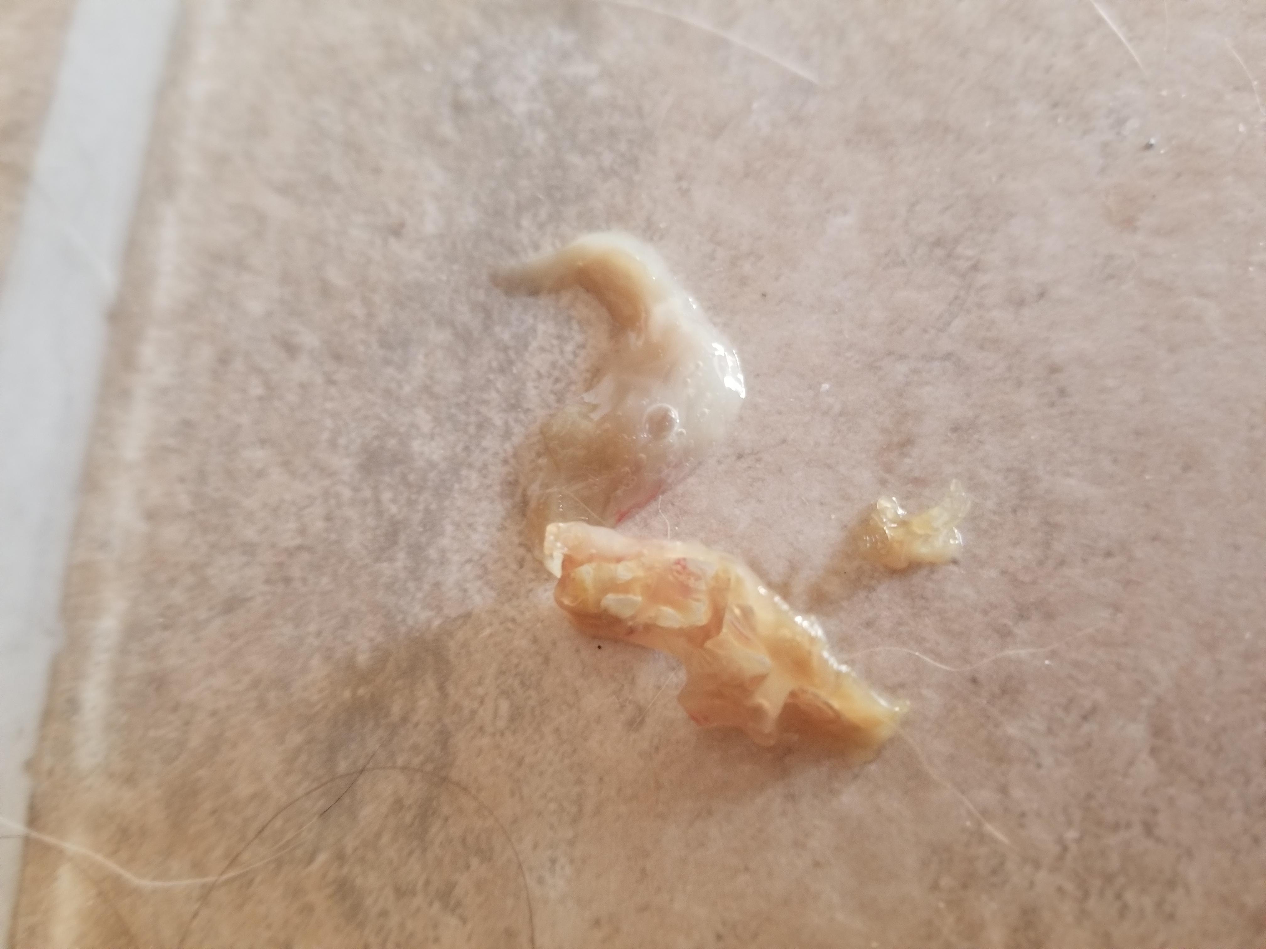 My cat just sneezed up this glorious wadosnot r/popping