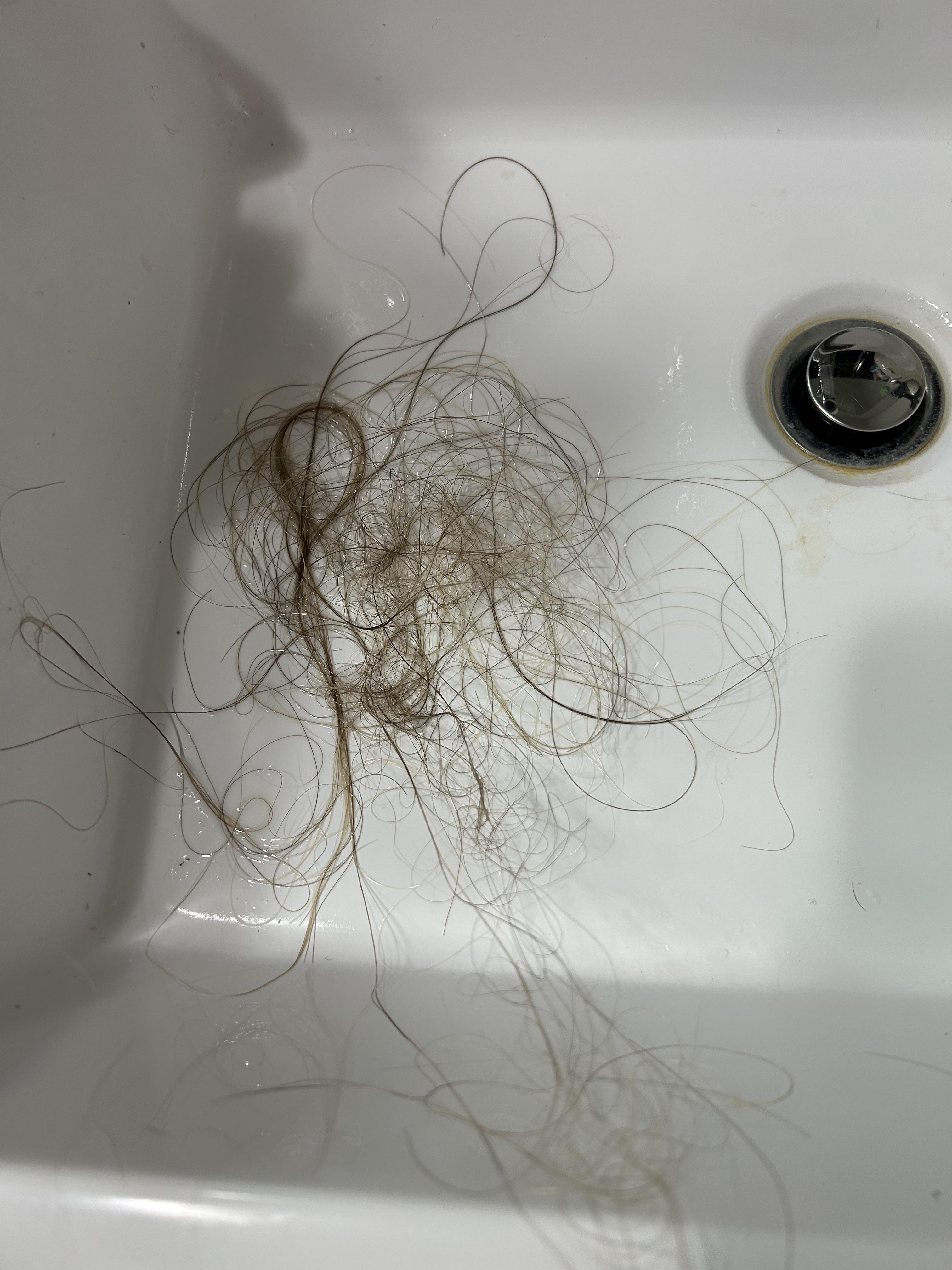 Is is normal to lose this much hair in one wash? I go about 4 days in
