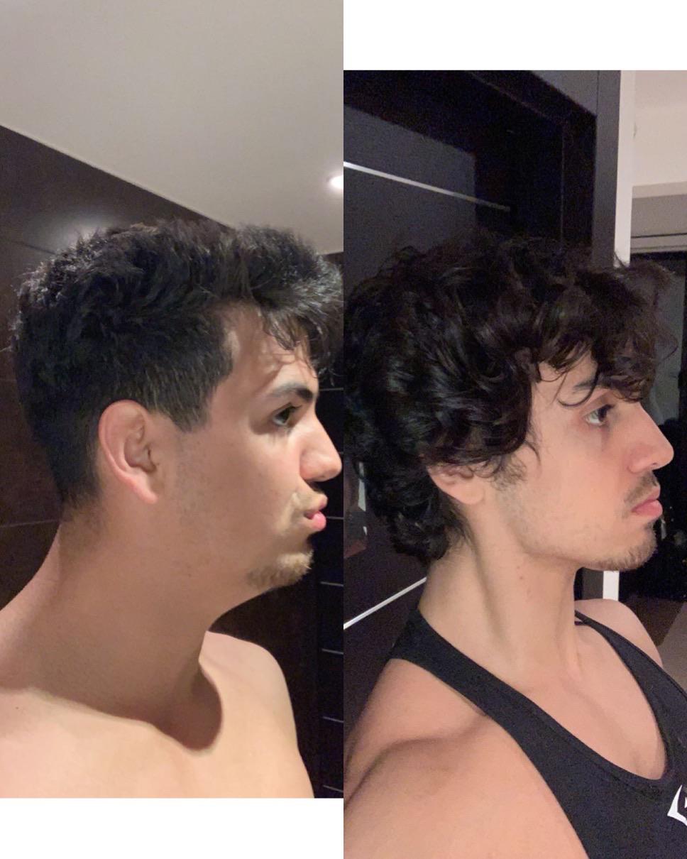 Been mewing for nearly 9 months, started nofap 3 months ago, lost a bit