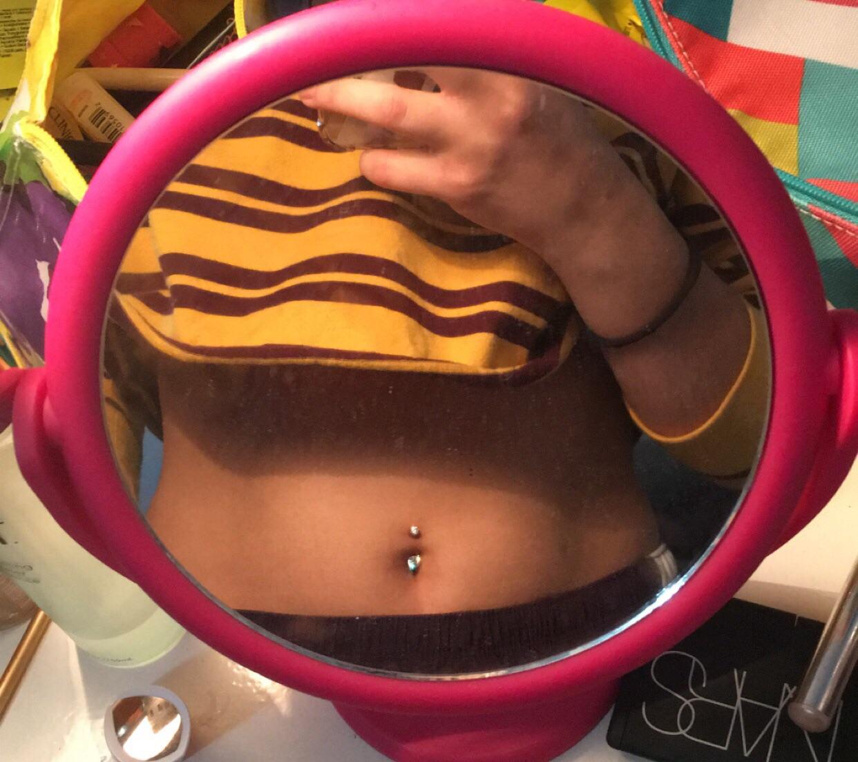 Hidden Keloid Pt 2 Navel upgrade! trying to get rid of irritation