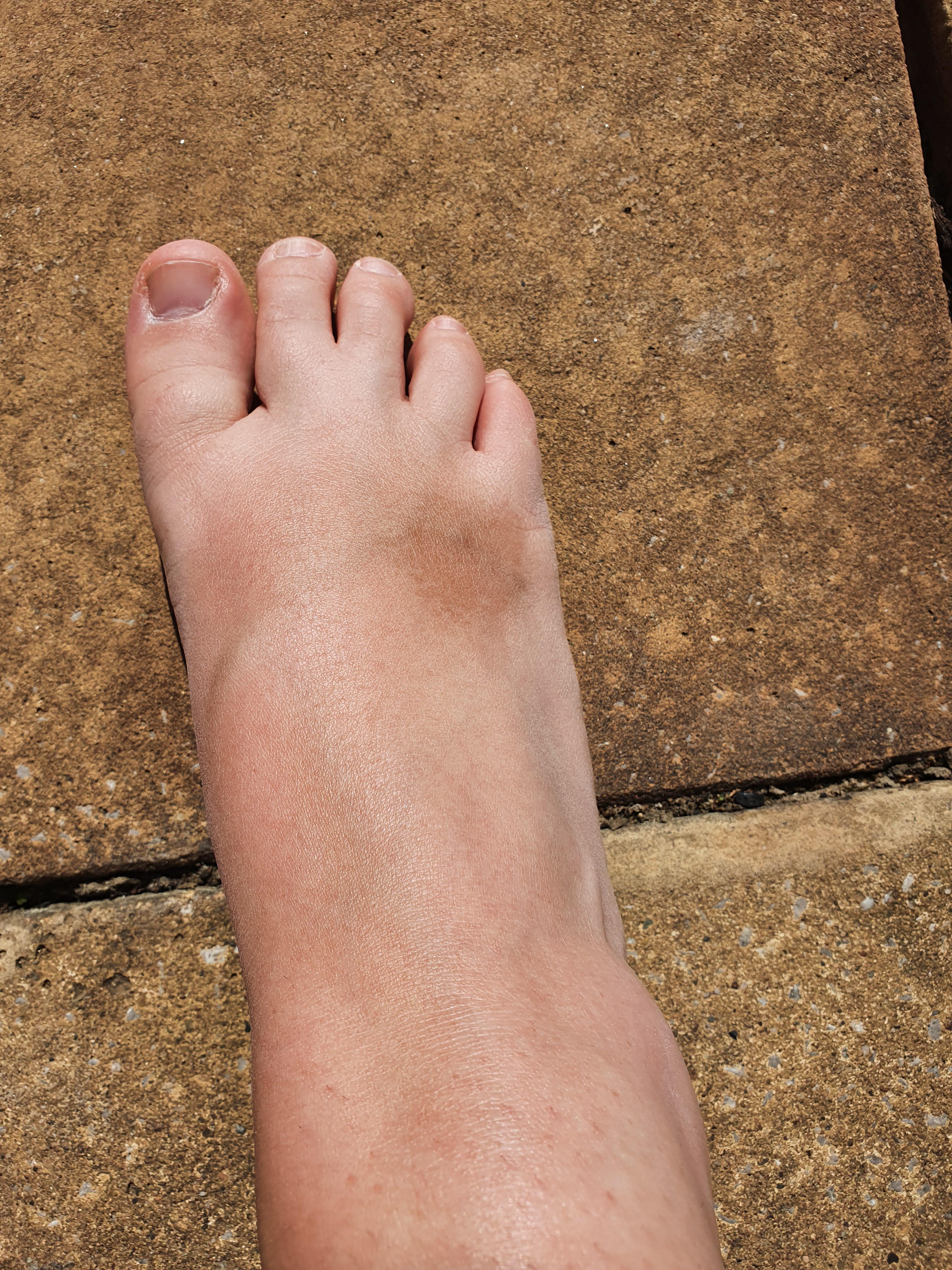 What is this mark on my foot? Had it for ages, just curious what it is