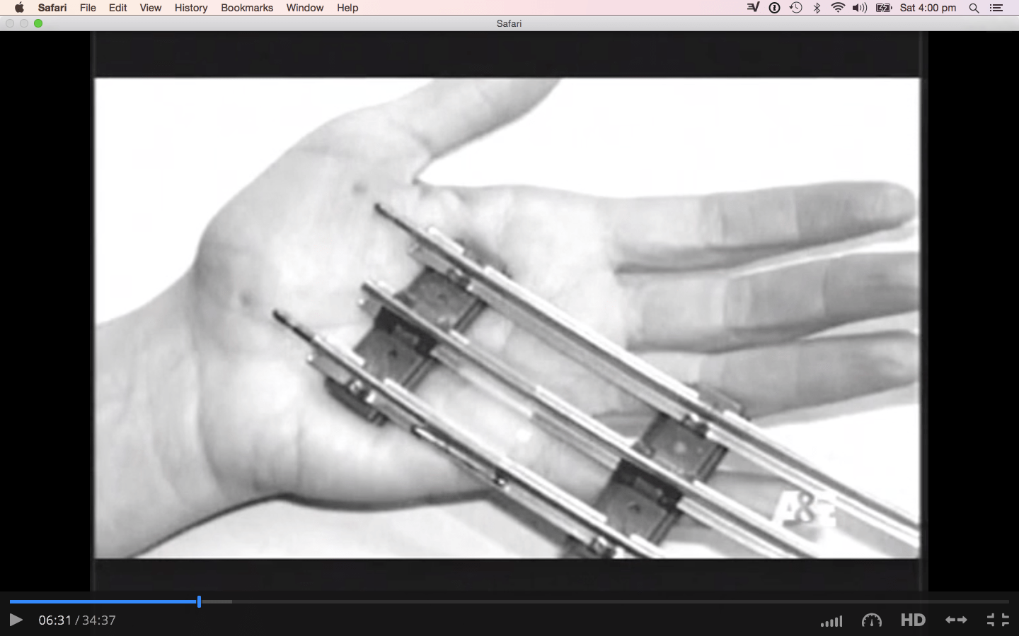 Sorry CBS doc, stun guns DO leave marks