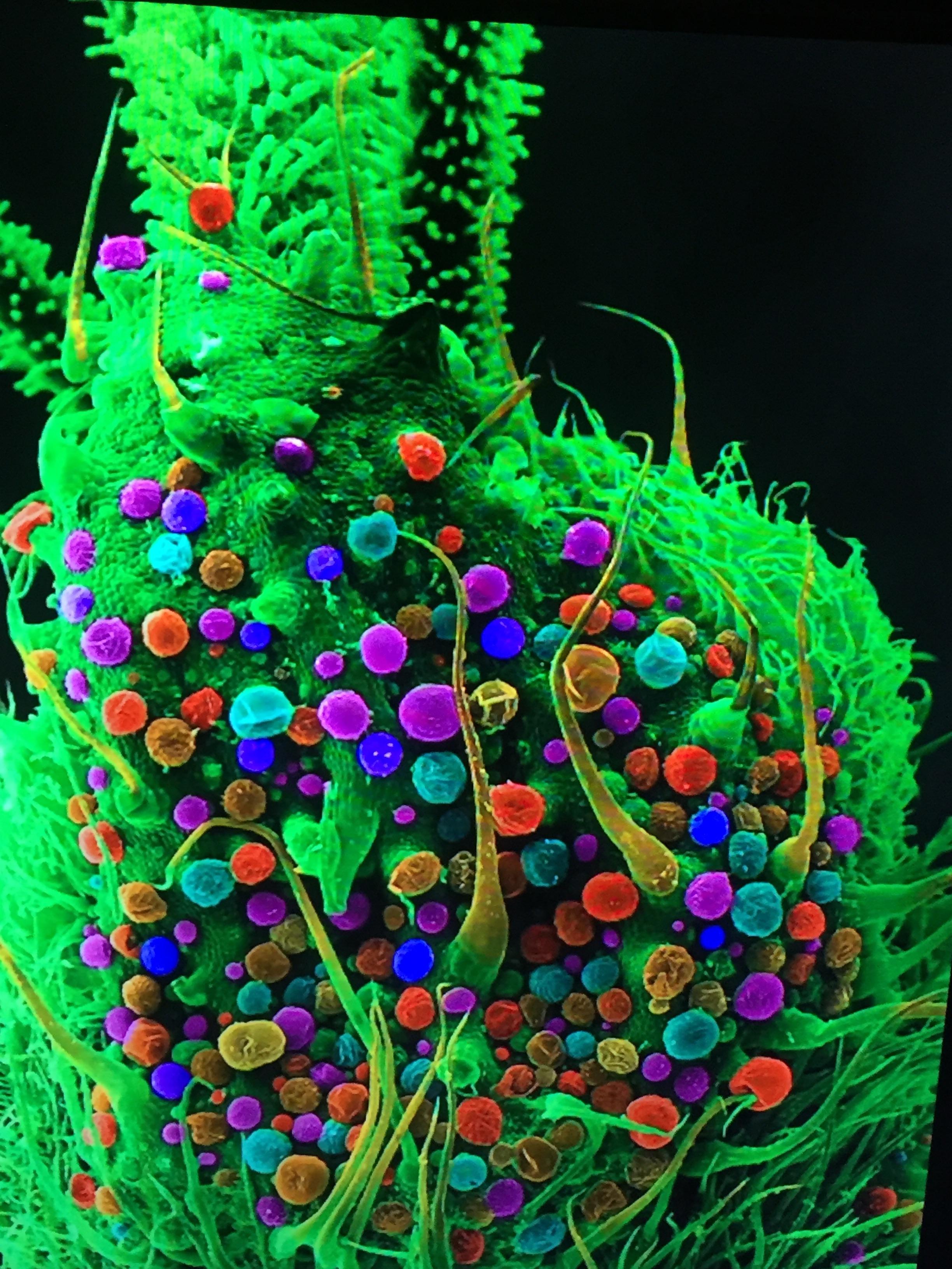 Marijuana under electron microscope weed