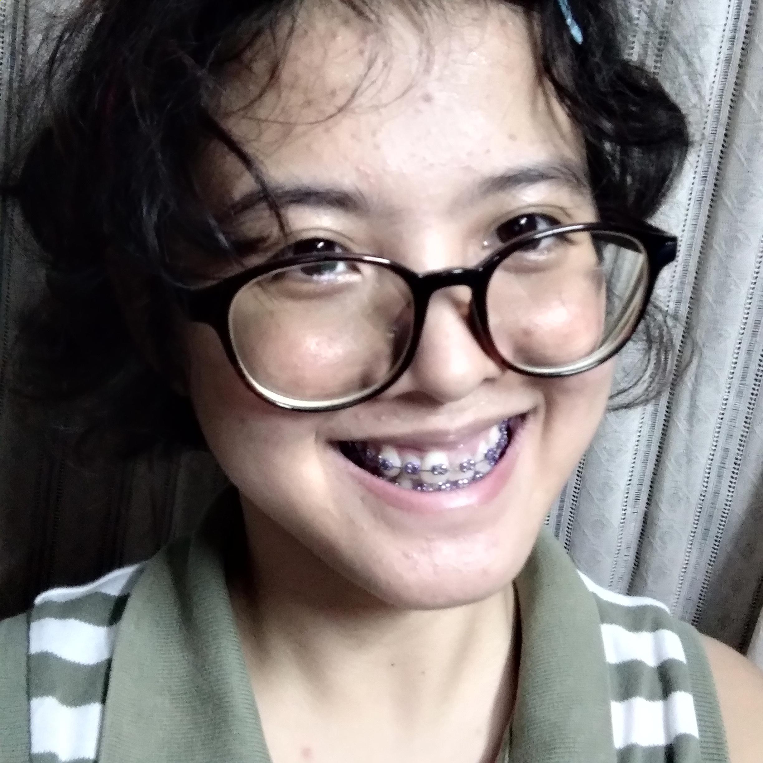Just got my braces yesterday. Any advice? Thanks in advance! r/teenagers