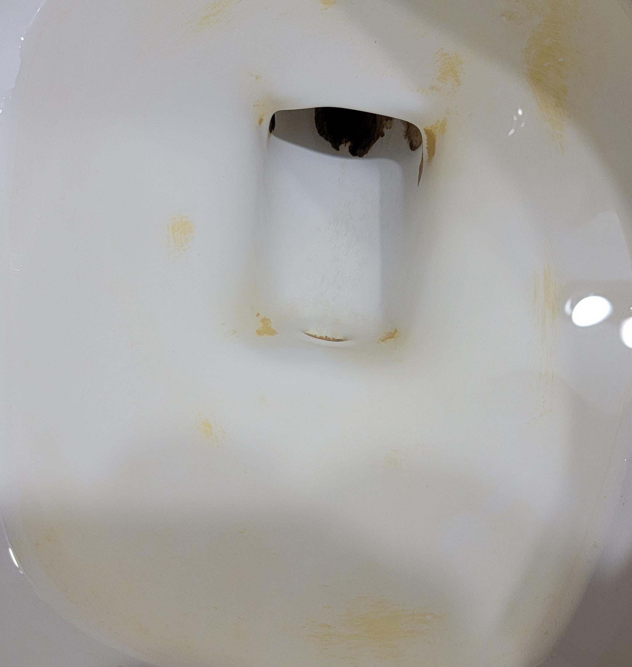What is this yellow buildup in my toilet and is there anyway to prevent
