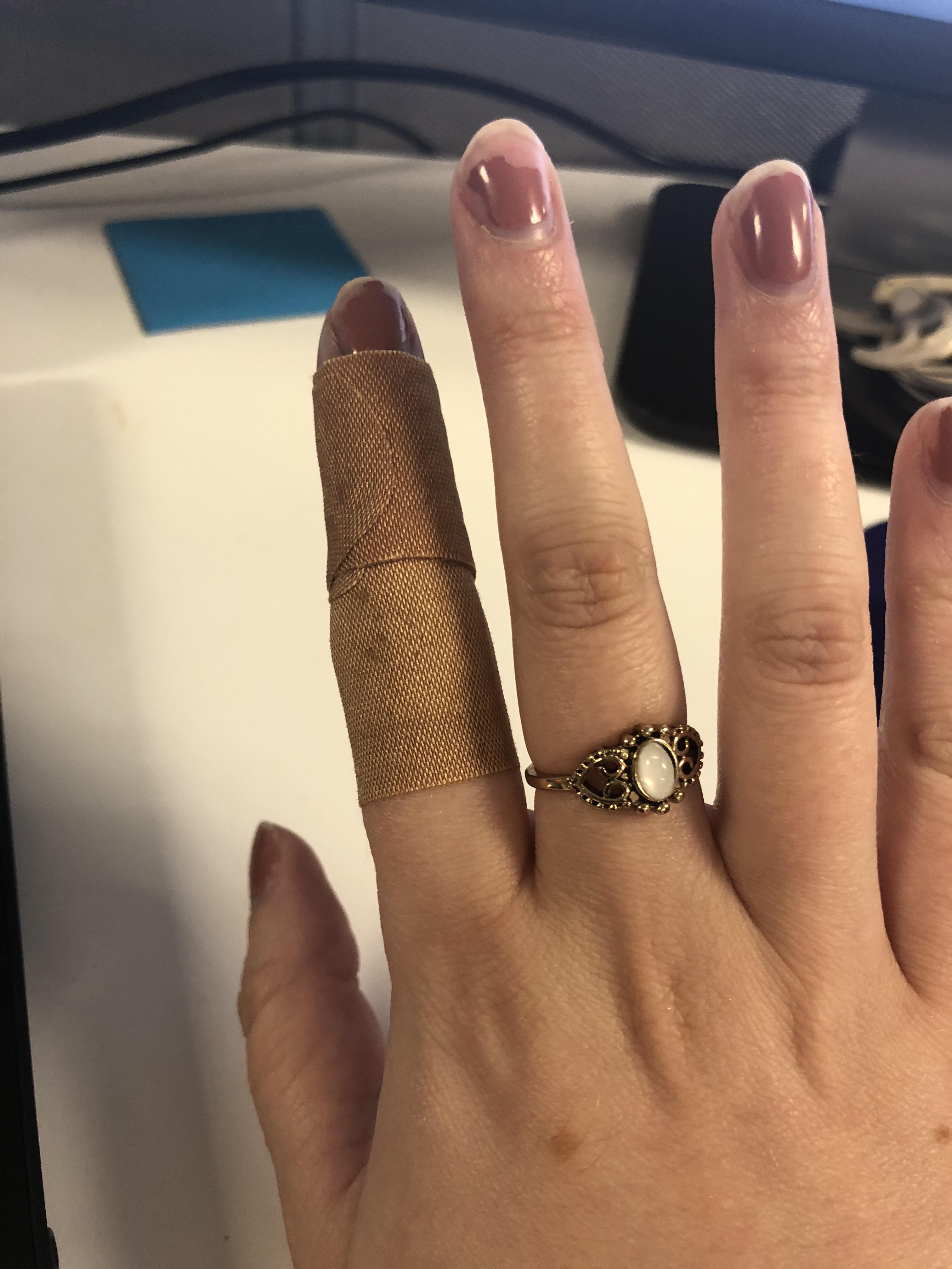 I have a skin condition that effects one of my fingers. It makes the