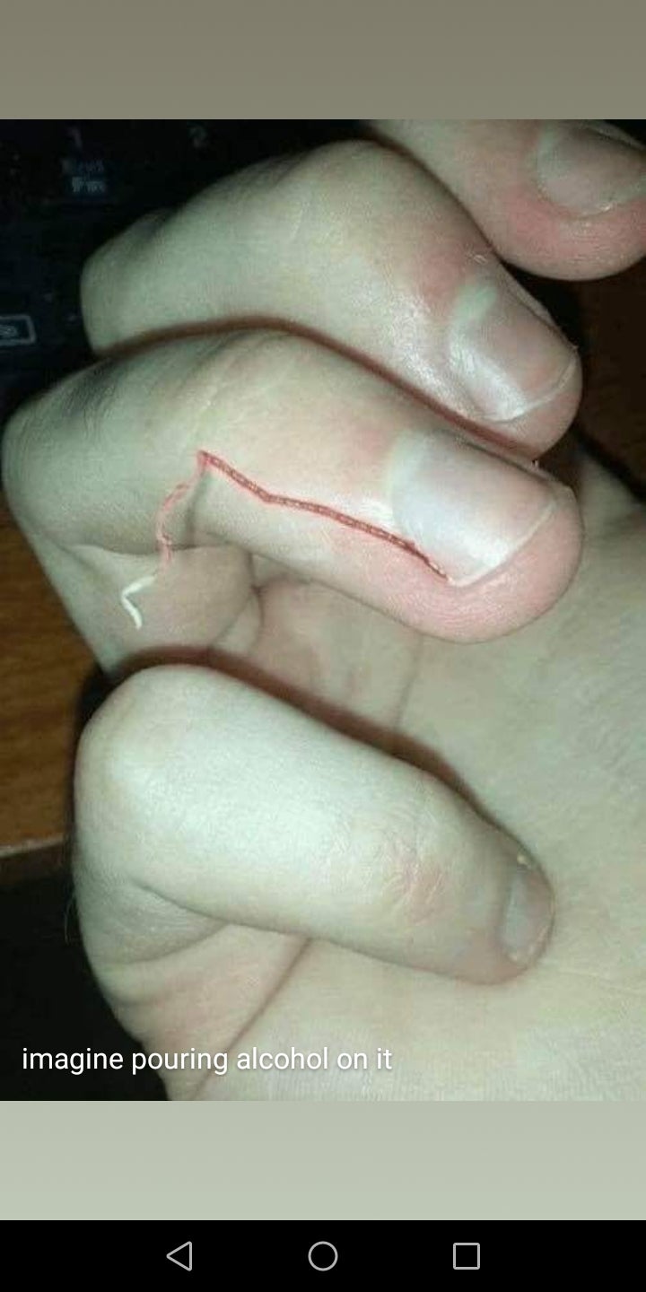 Thanks I hate pulling nail skin. r/TIHI