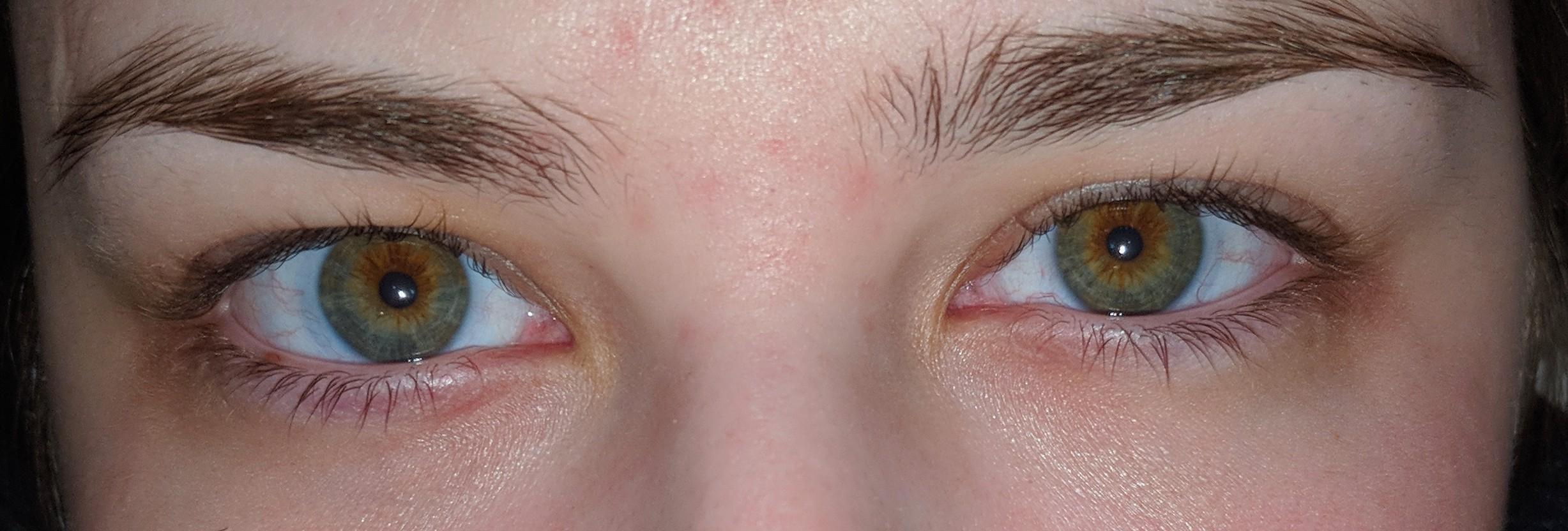 Hazel or central heterochromia? r/eyes