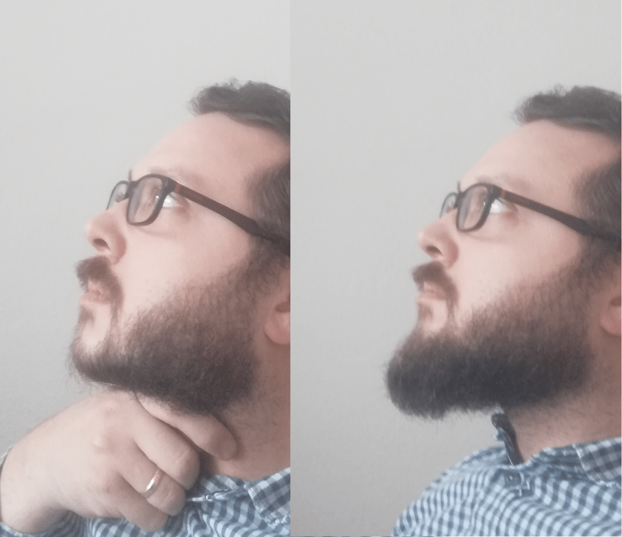 No chin, small chin or double chin? Get a beard and look majestic. r