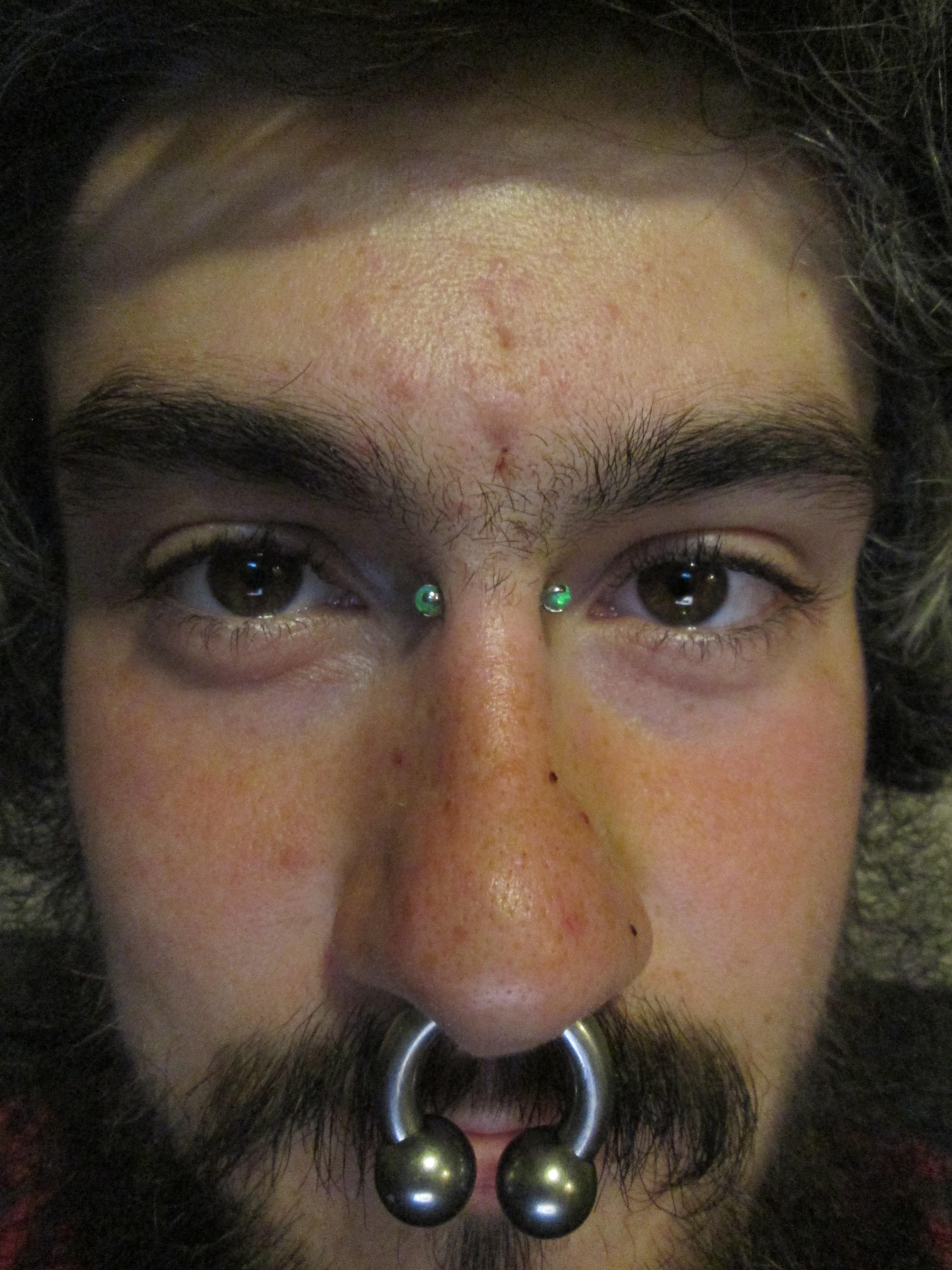 My vertical bridge rejected after 3 years. Had matching green opals in