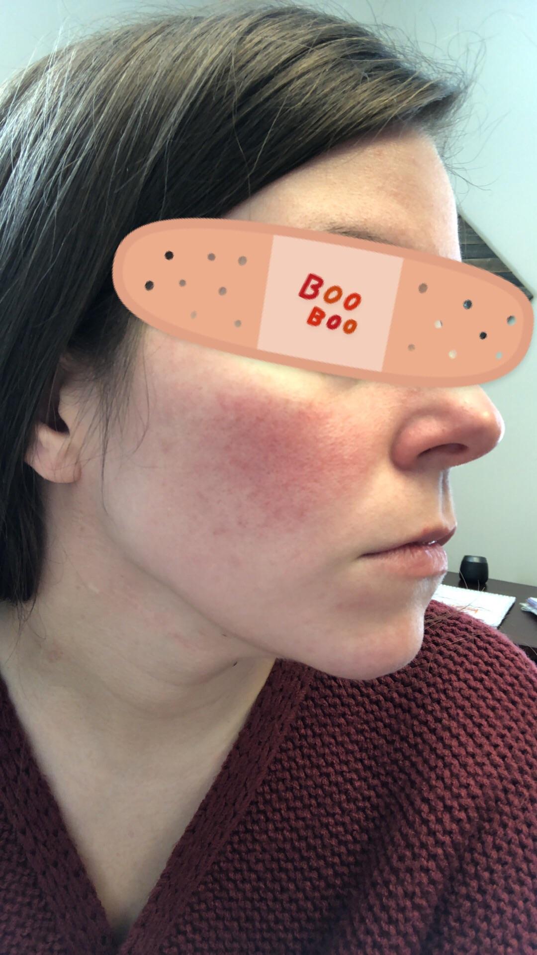 [routine help] I have pretty noticeable redness & uneven skin tone