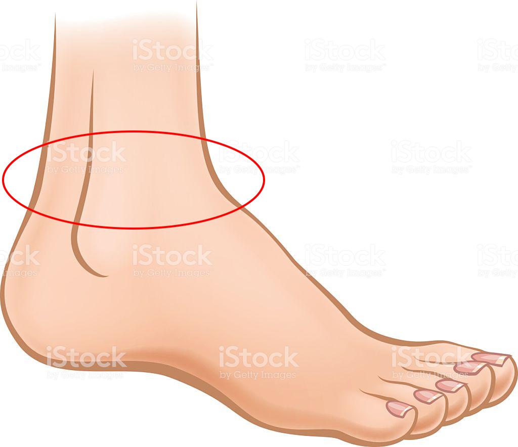 Swirlster First Sore Feet After Running