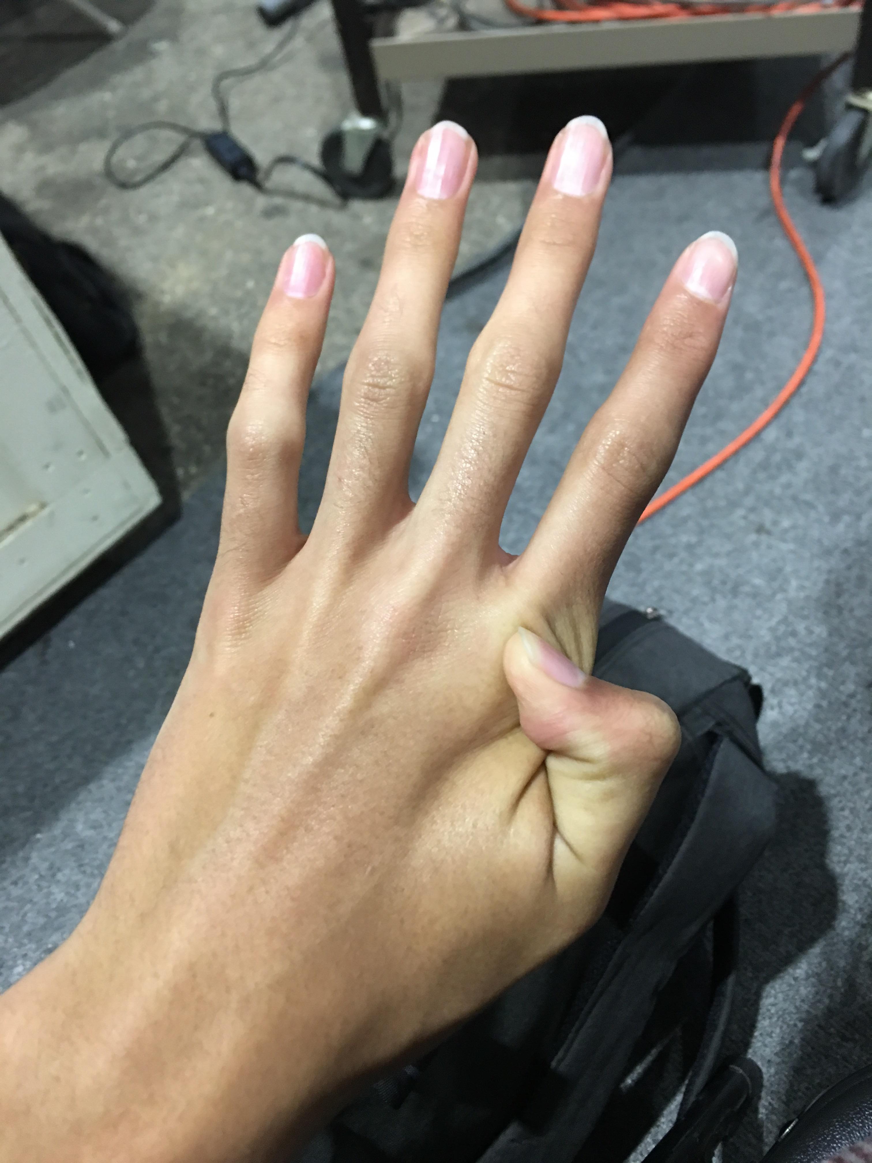 PsBattle Thumb that’s behind hand