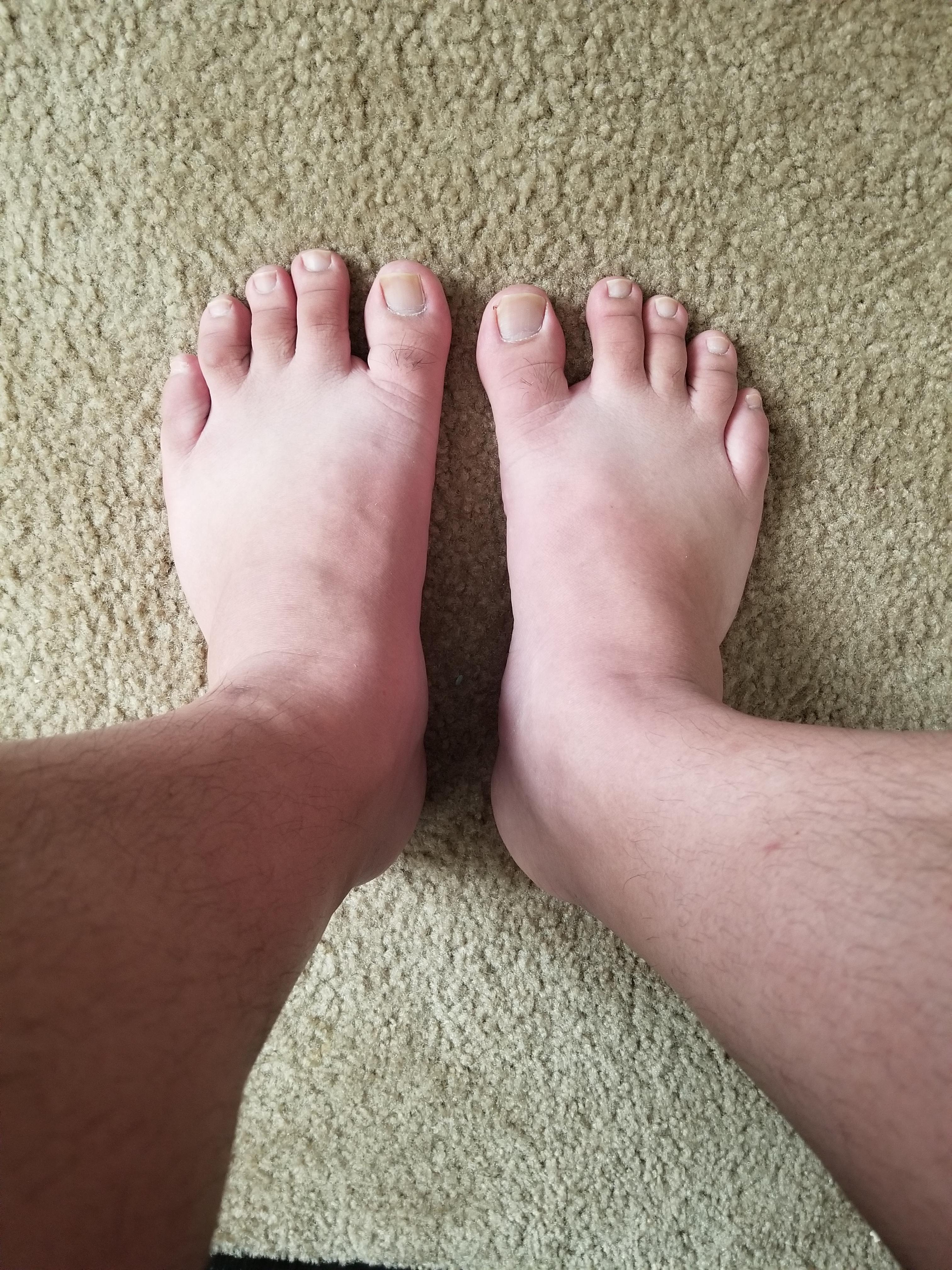Lol would my feet be considered wide? r/widefeet
