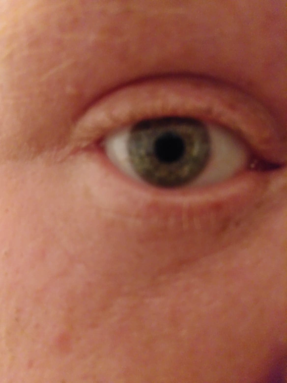 Allergies are killing me but I still got great green peepers. r/eyes