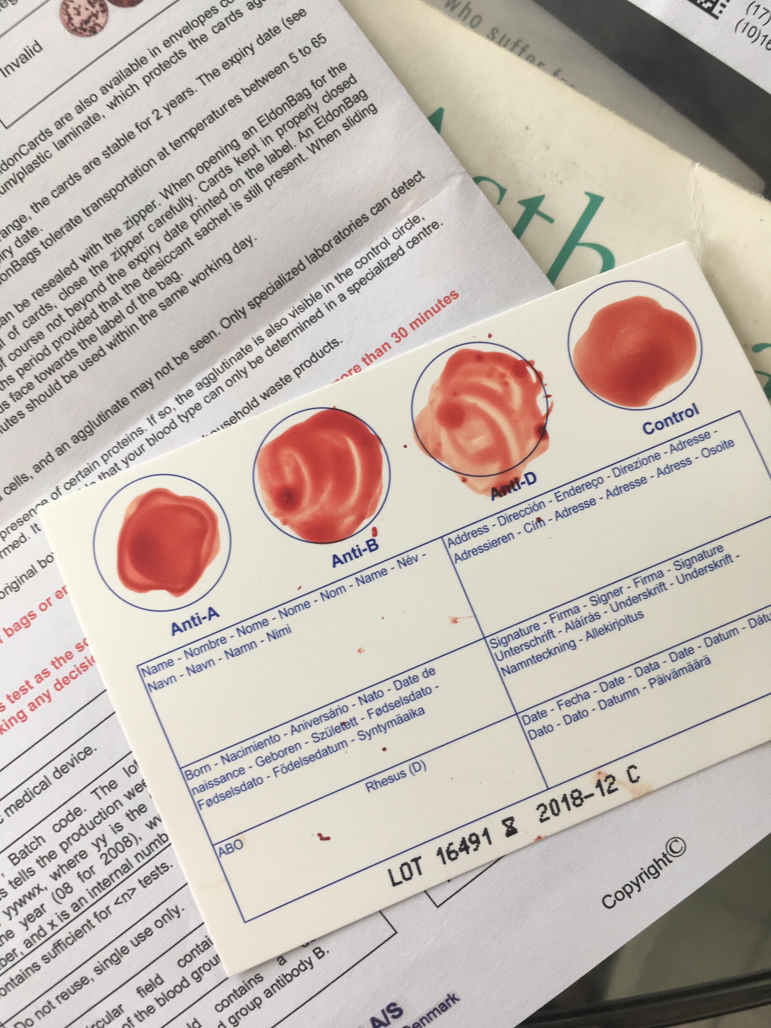 Does anyone see agglutination anywhere but D? I'm testing my blood type