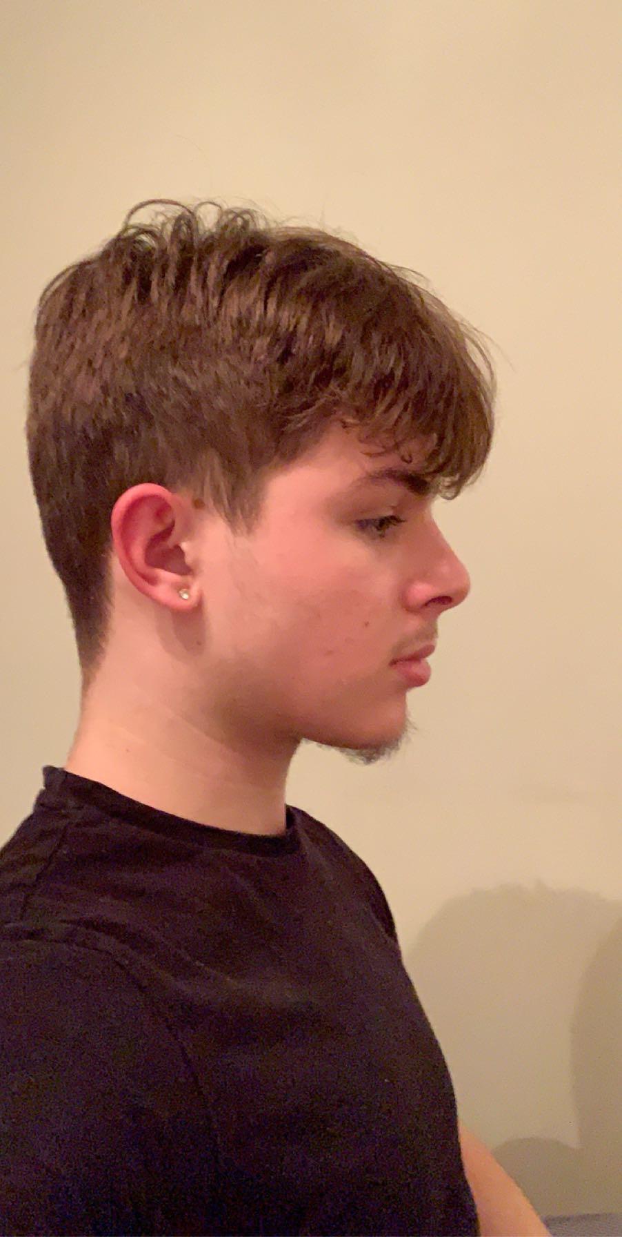 Anything wrong with my side profile which will be fixed whilst mewing? r/orthotropics