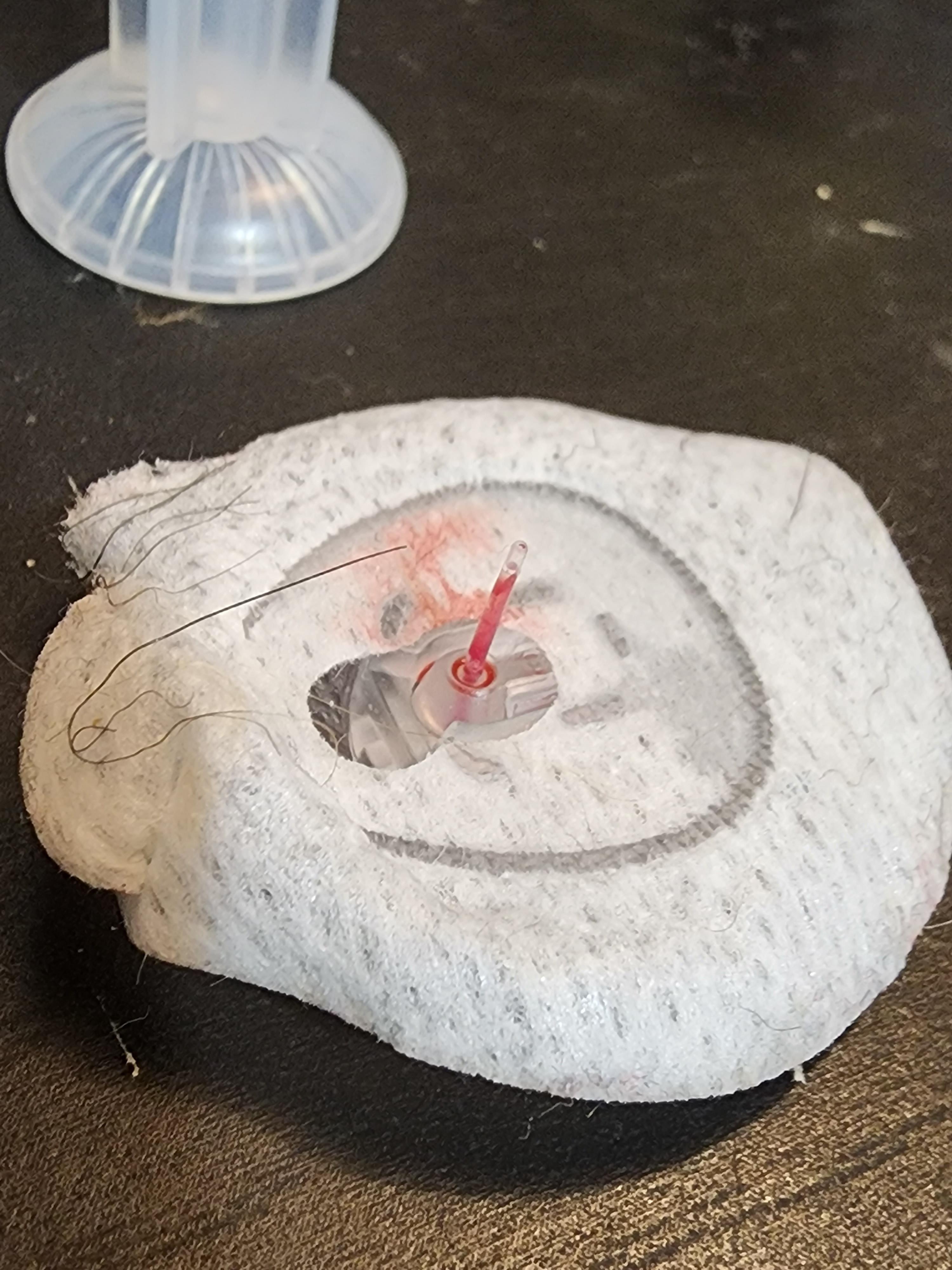 Is this normal after changing a new minimed mio advance infusion set? I