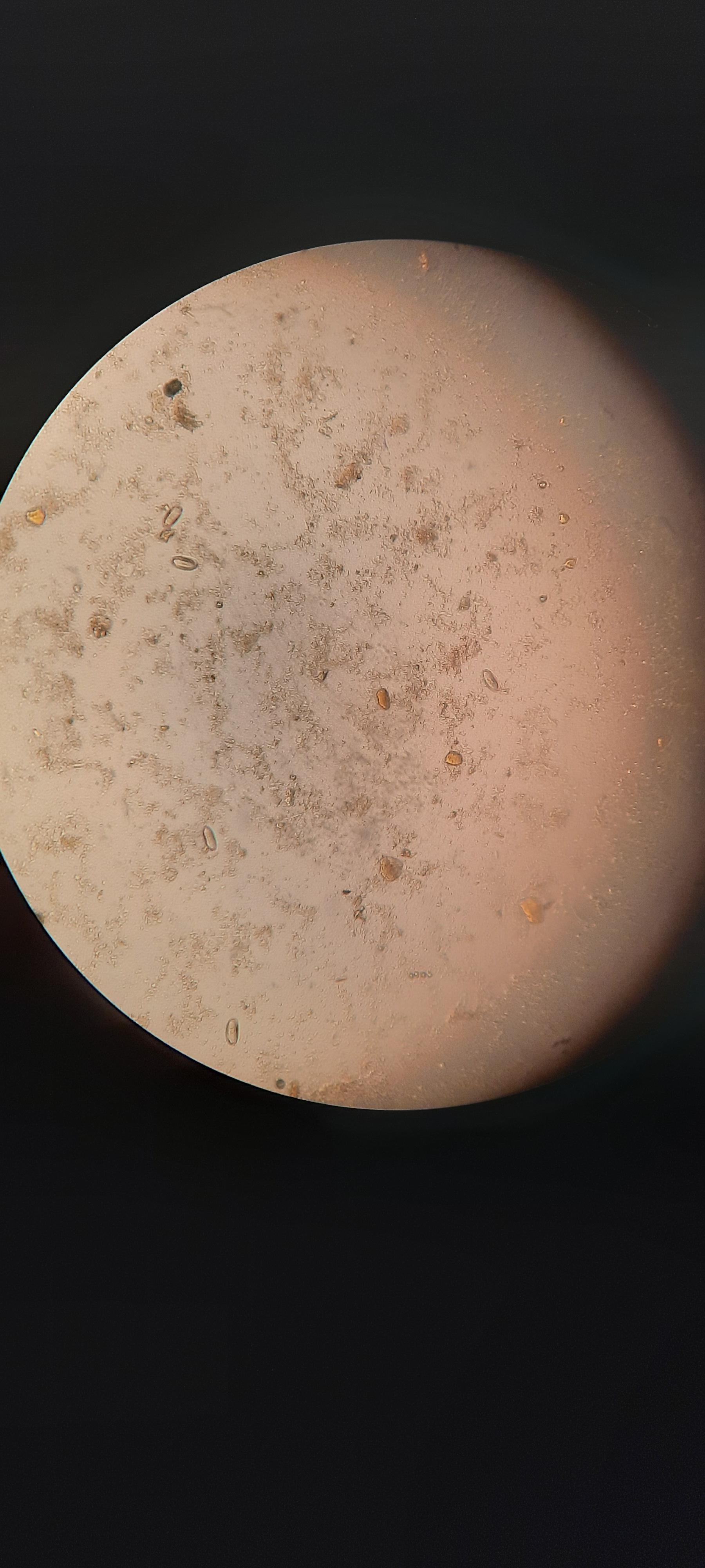 Enterobius vermicularis eggs. Enterobiasis can be diagnosed by applying