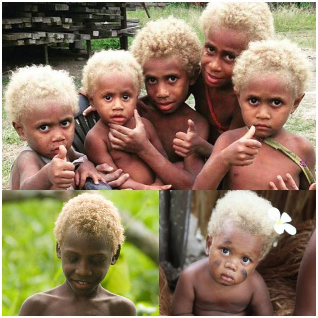Melanesians With Blue Eyes