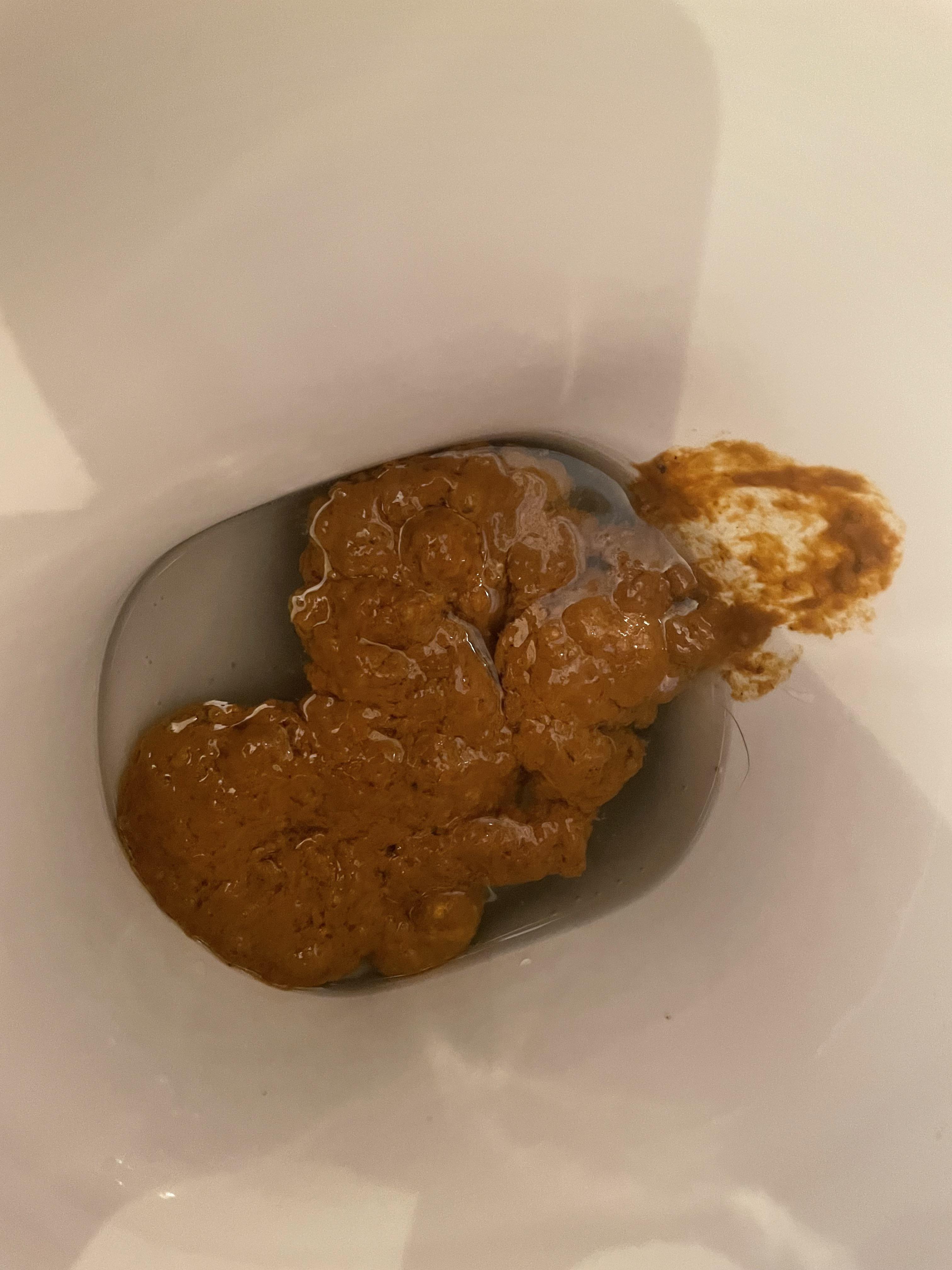 Stomach cramps and bloating with this type of stool r/poop