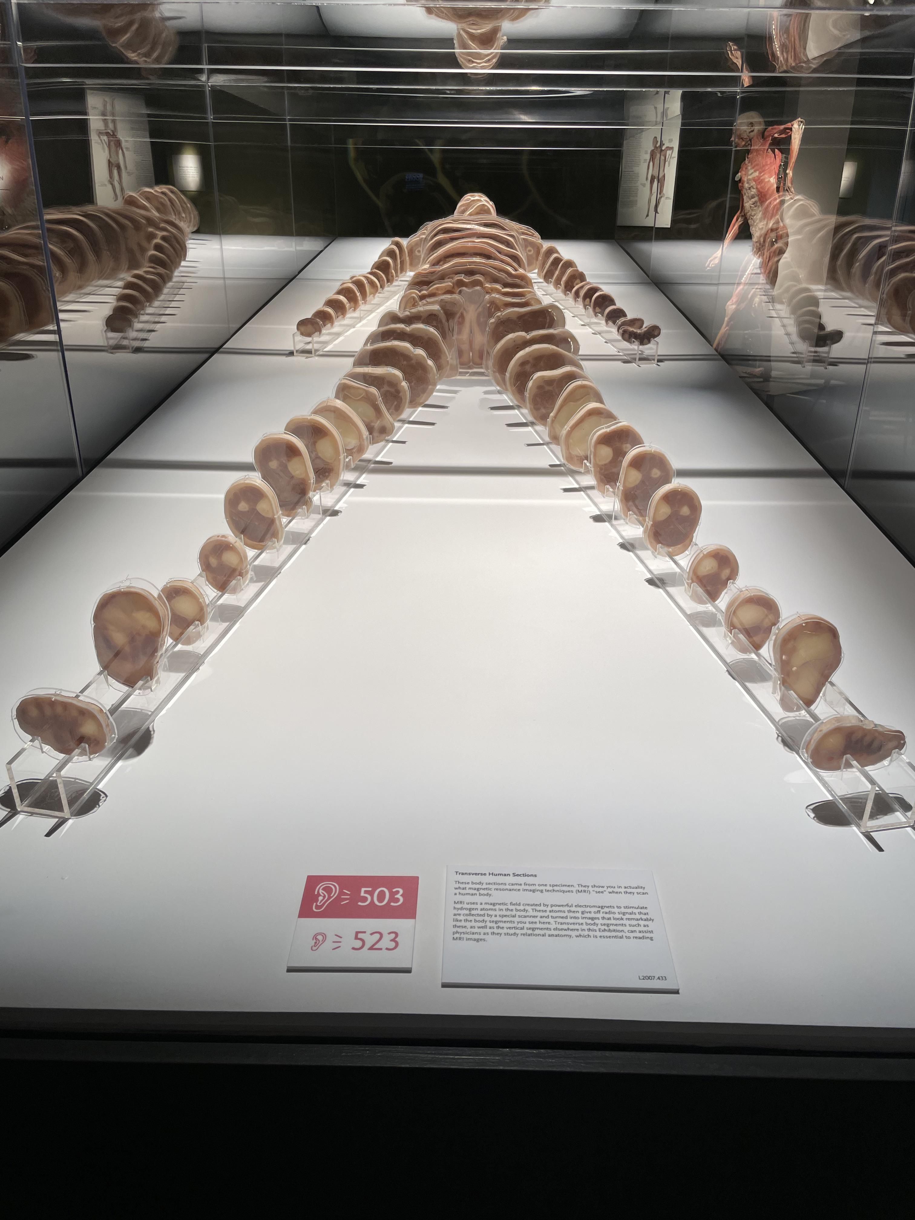 The Bodies Exhibit