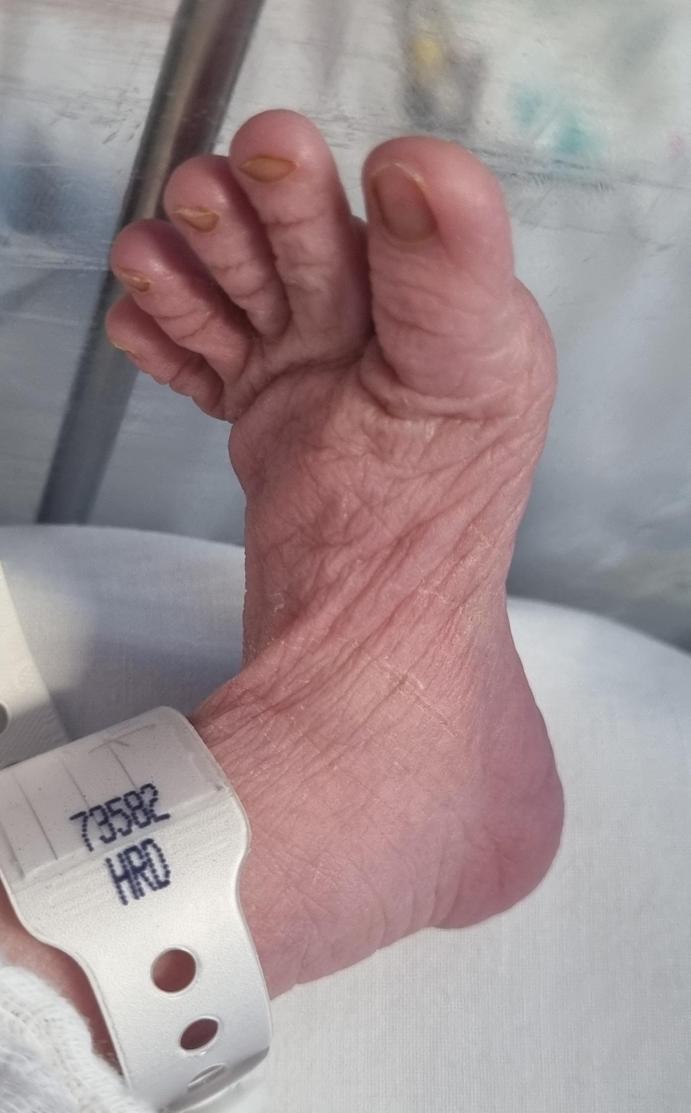 overview for ArguesWithZombies