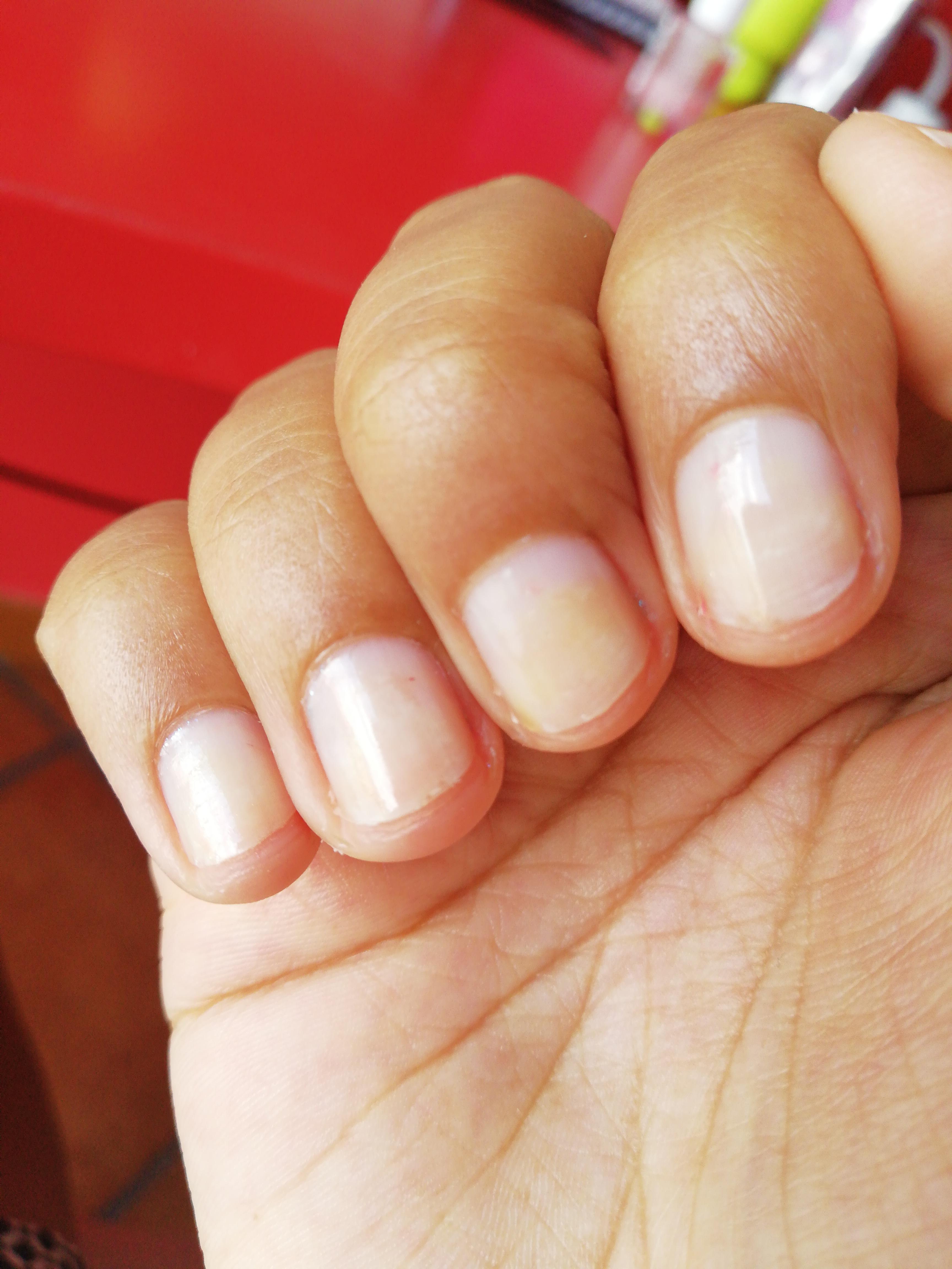 I already tried to buffer them, what can I do? r/Nails