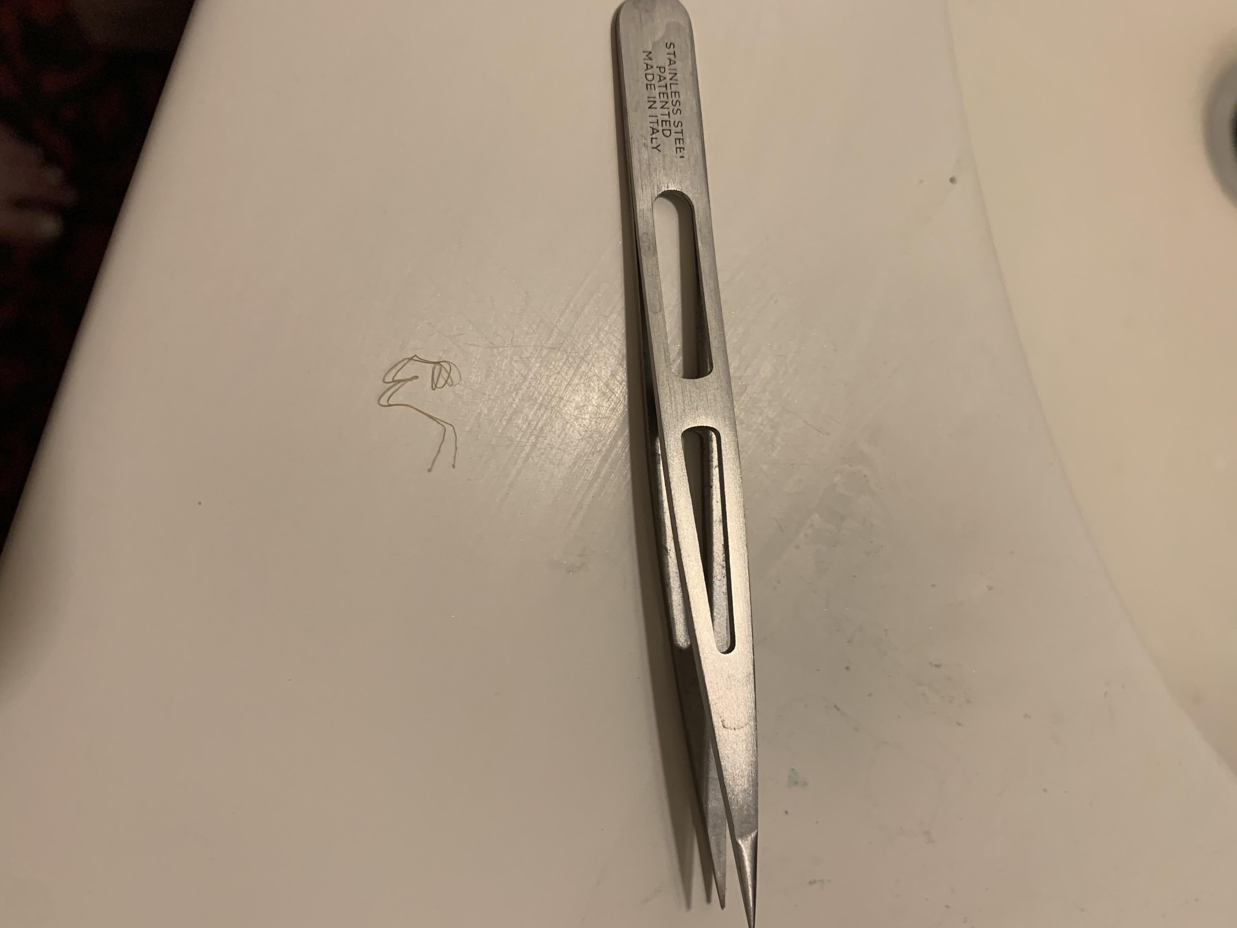 I’ve had a hard bump on my bikini line for quite a few months now. It