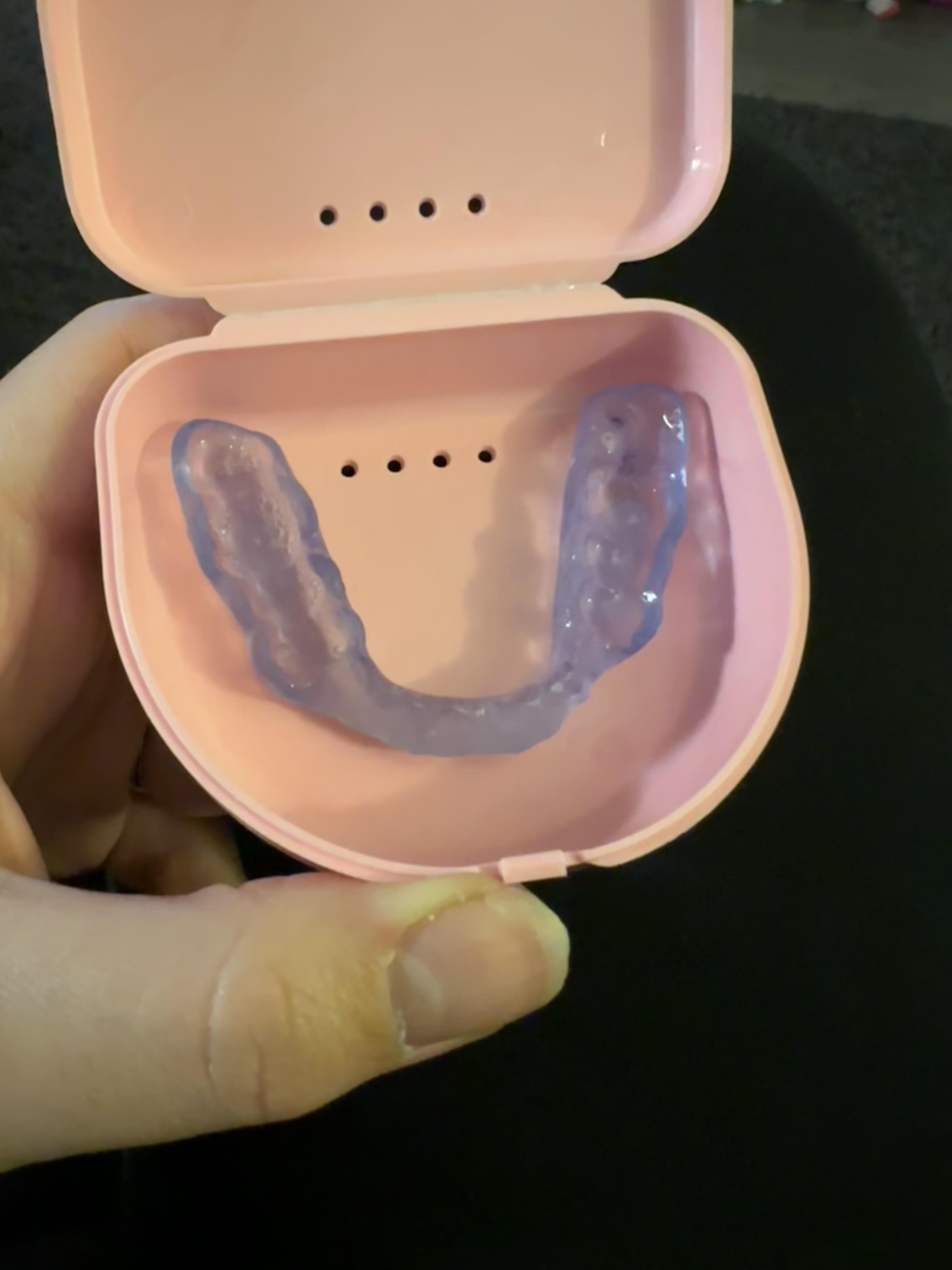 Tmj mouth guard? r/TMJ