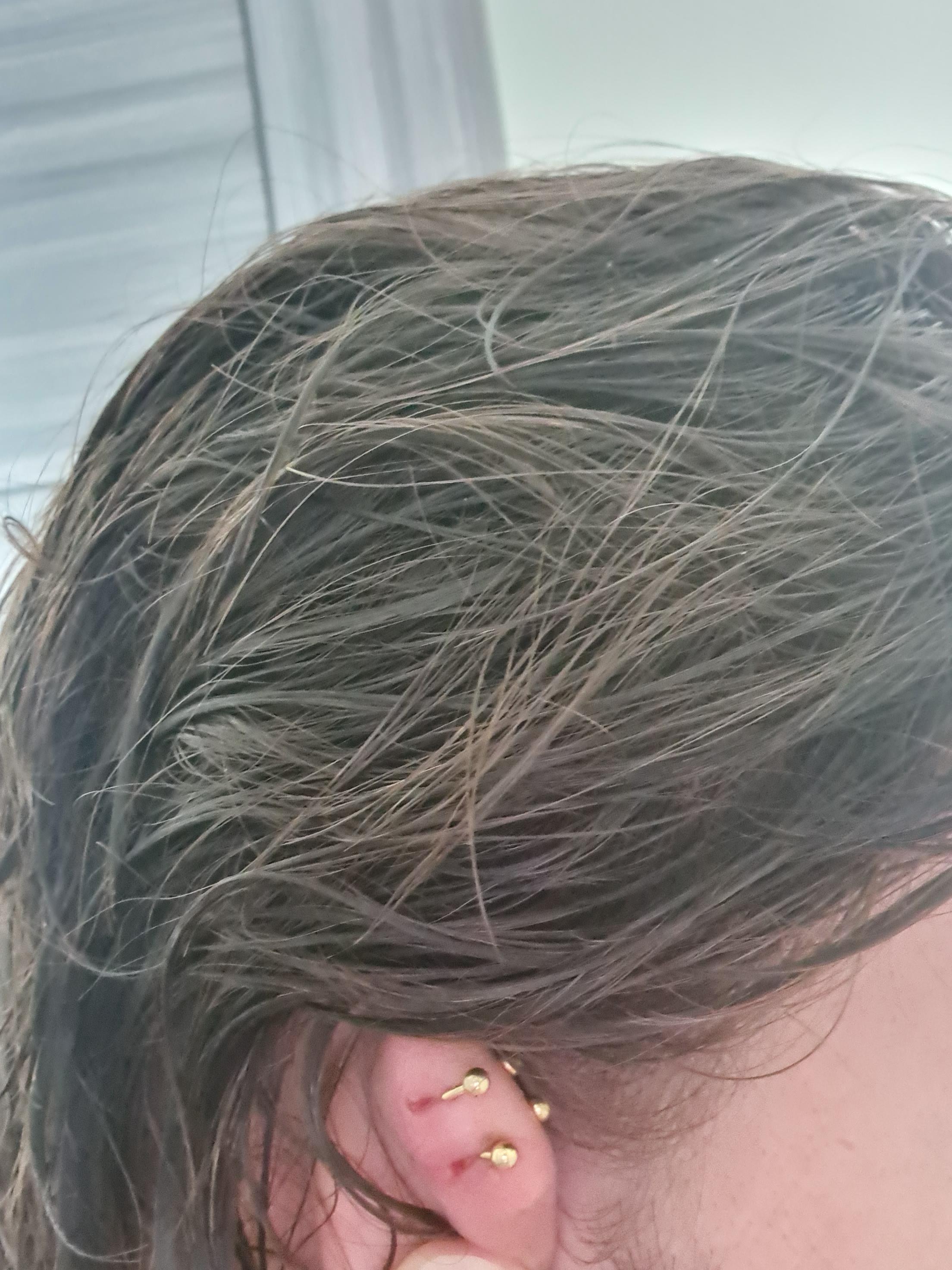 Piercing migration, what should I do??? r/piercing