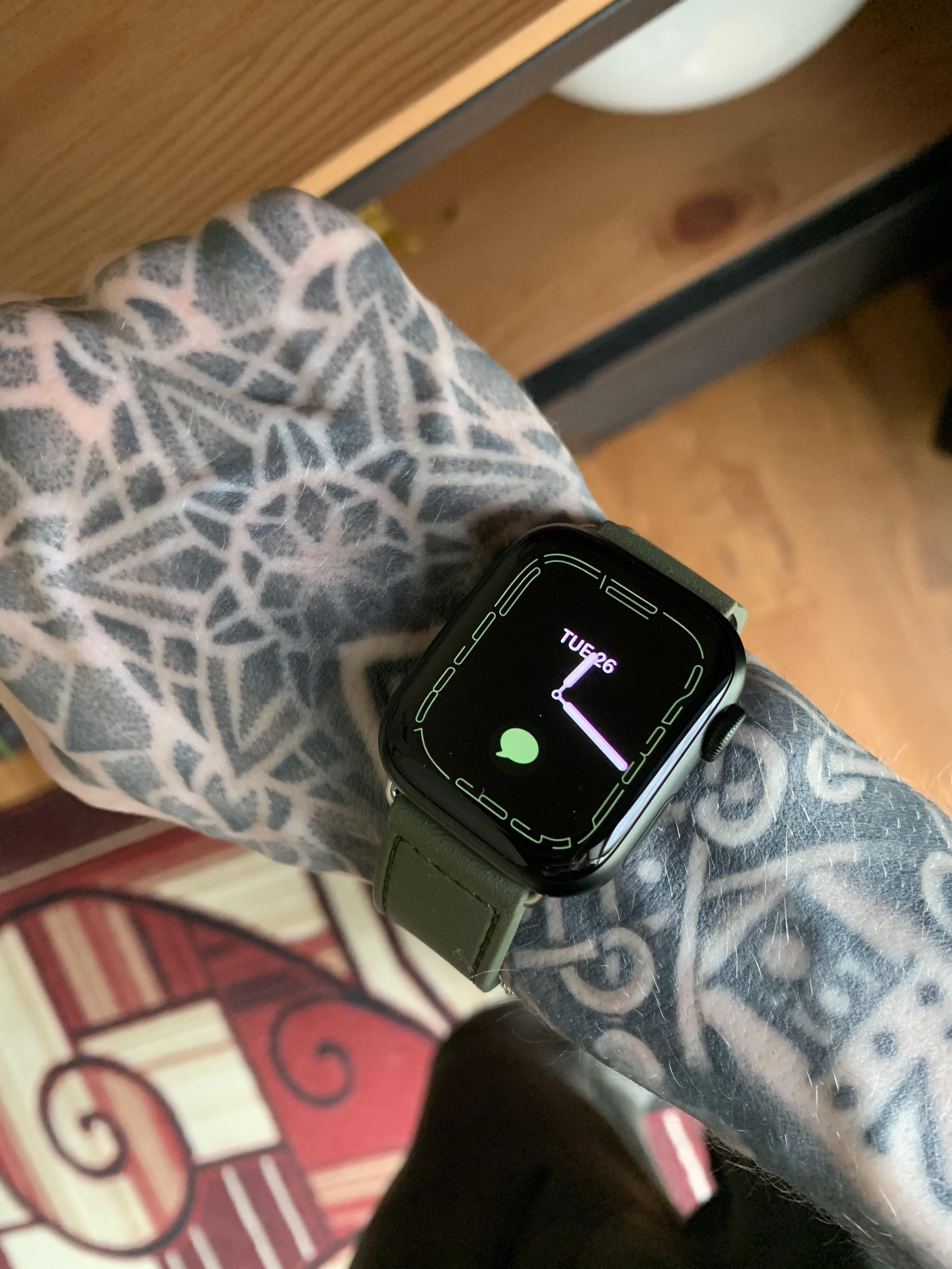Confirmed tattoo fix! Epoxy Bottlecap Sticker Fixed 100 of Issues on my Series 7 r/AppleWatch
