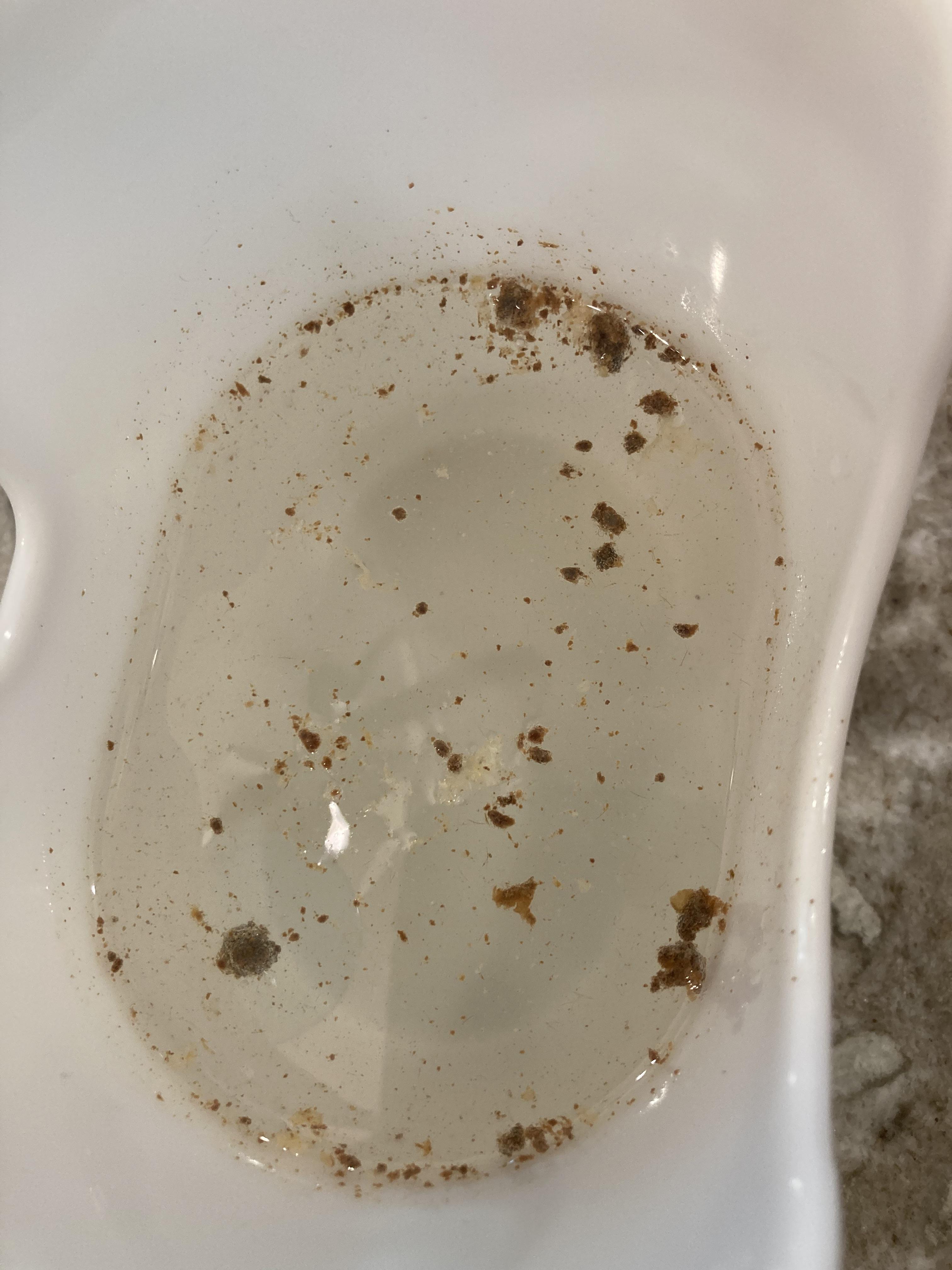 Flushed my ear and omg r/earwax