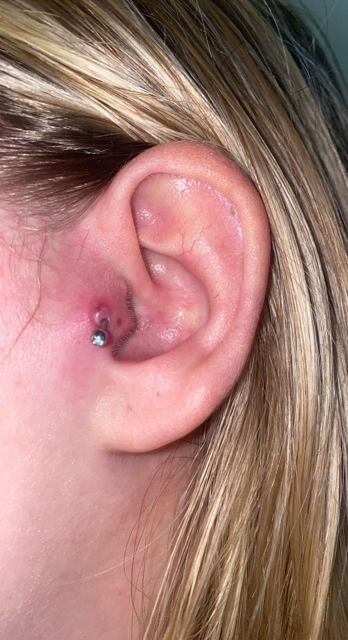 Swollen Tragus Piercings Causes And Treatment, 50 OFF