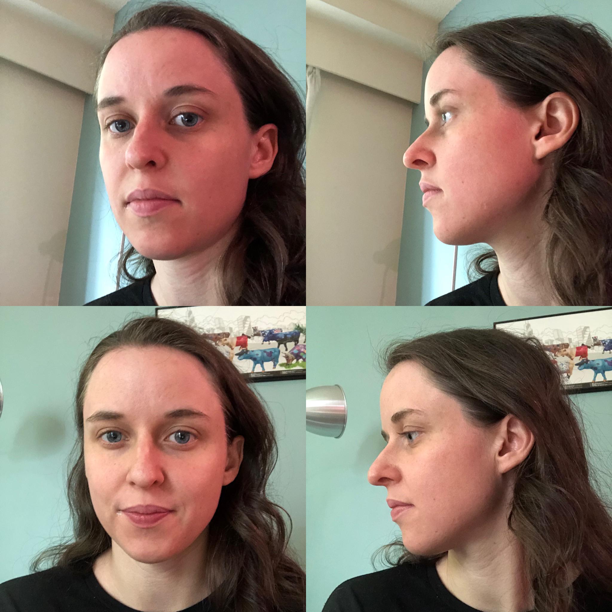 I don't mind my nose from the front but I hate my sideview ( My nose