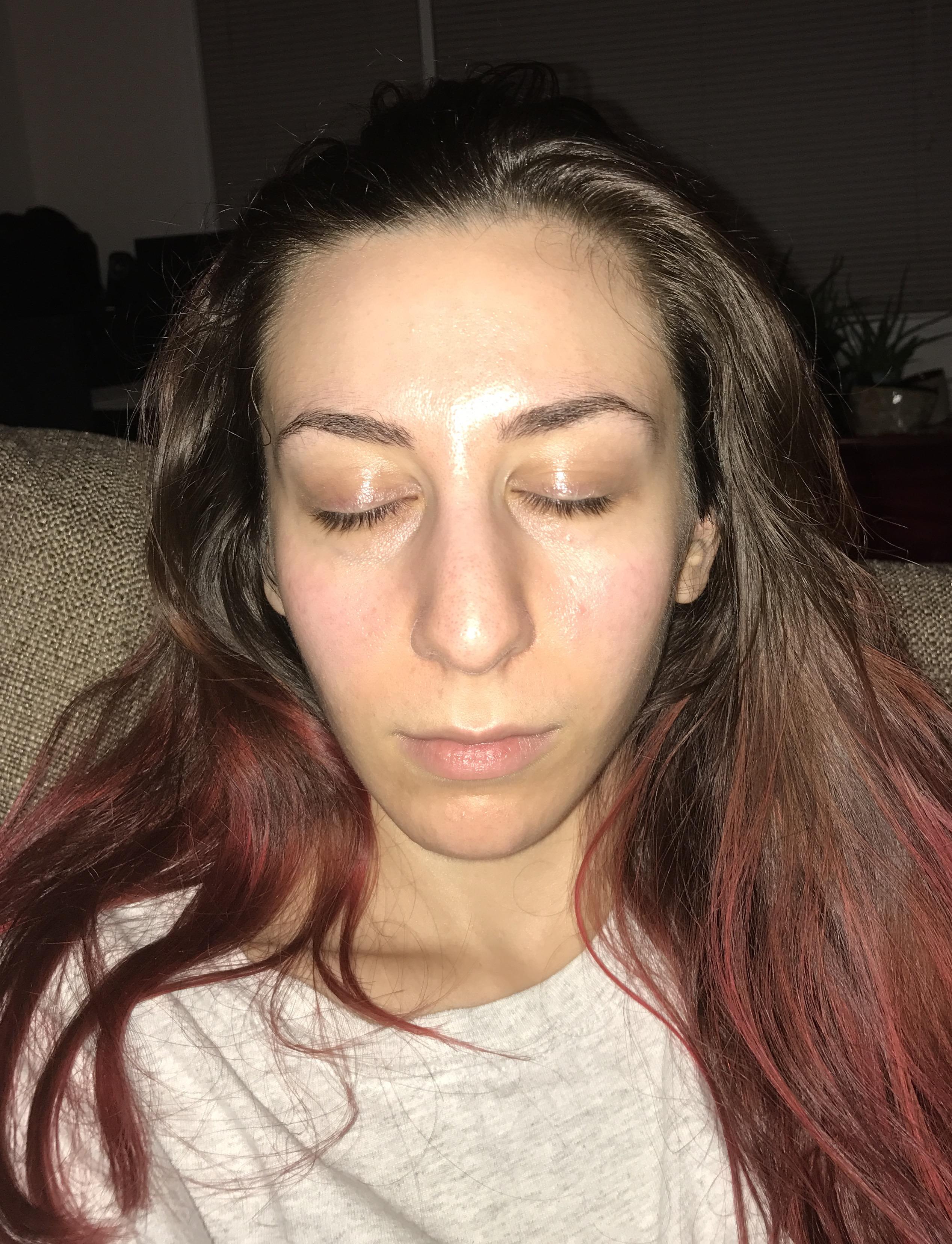 [Skin Concerns] How do I make the middle of my face less red