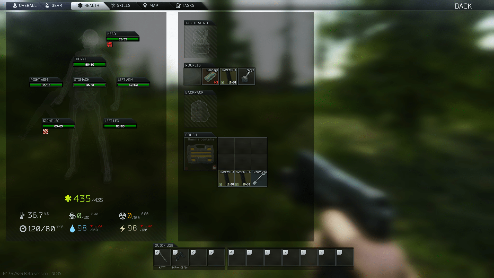 Spawned into a raid with a fracture and a tremor. Bug or am I doing