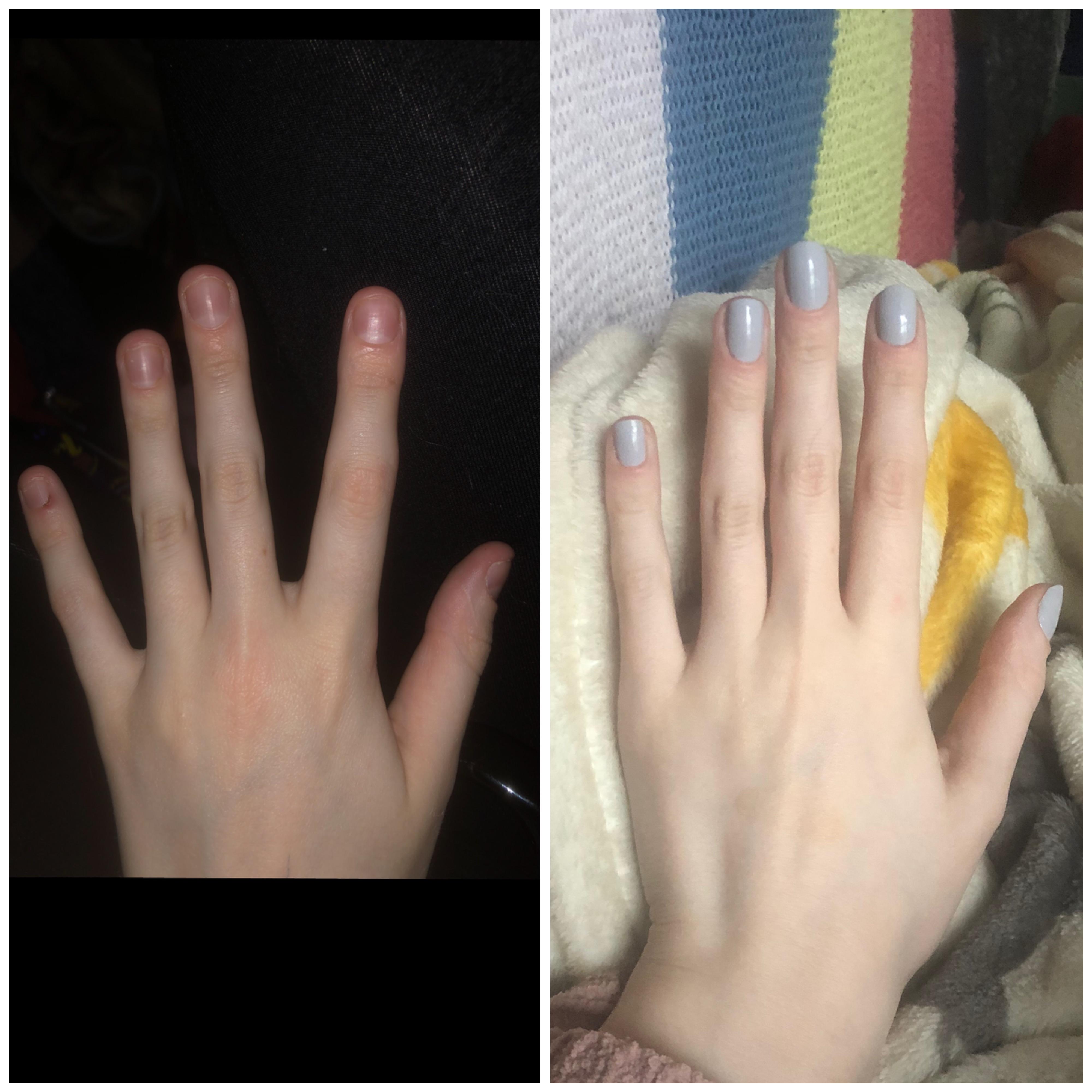 nail growth in about 2 months, been biting on and off for 19 years r