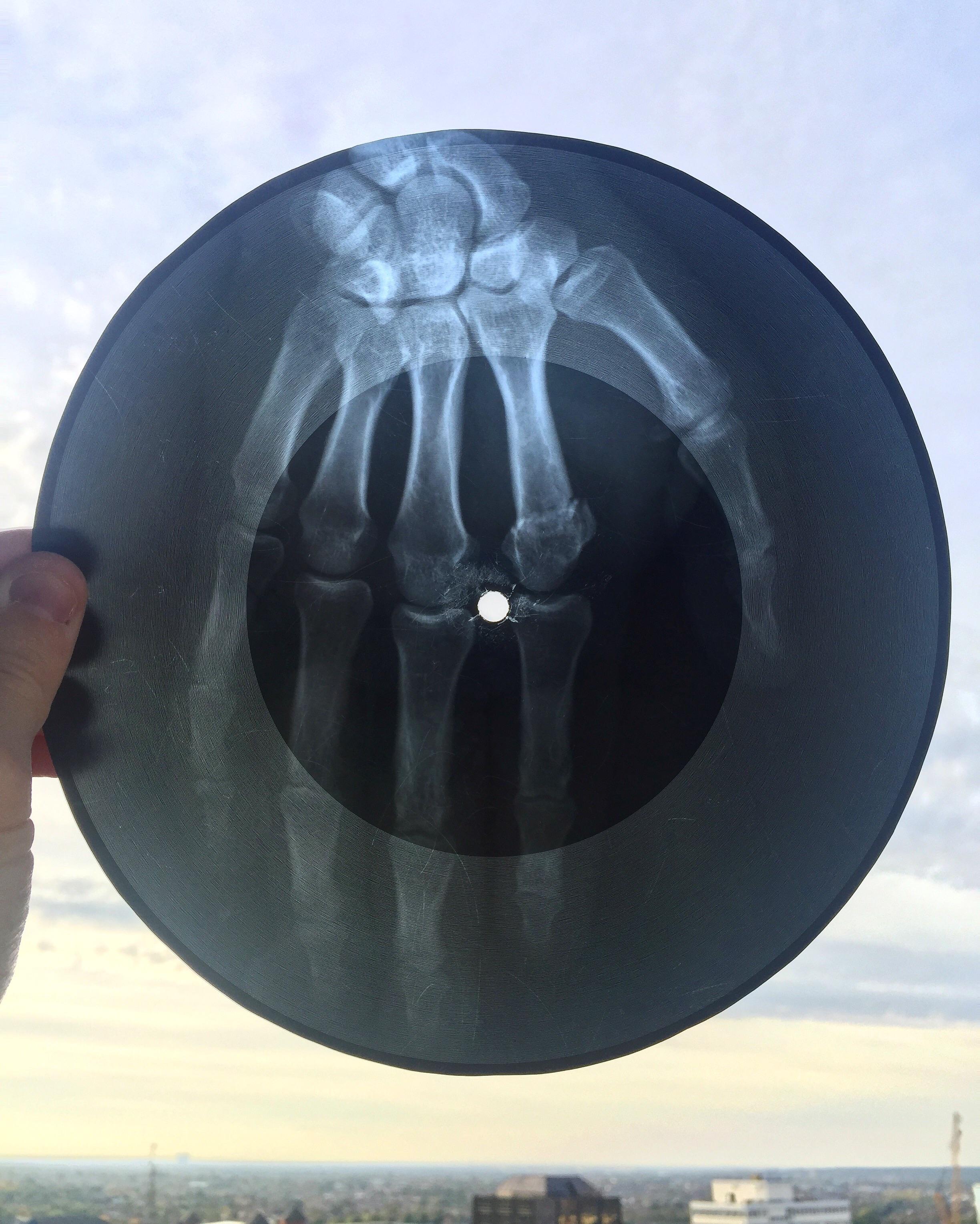 XRay ‘Bone Music’ Record r/vinyl
