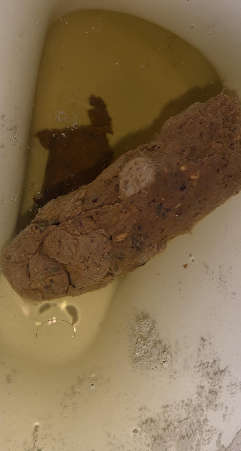 Does that look like mucous in my stool? Idk if I should poop examined