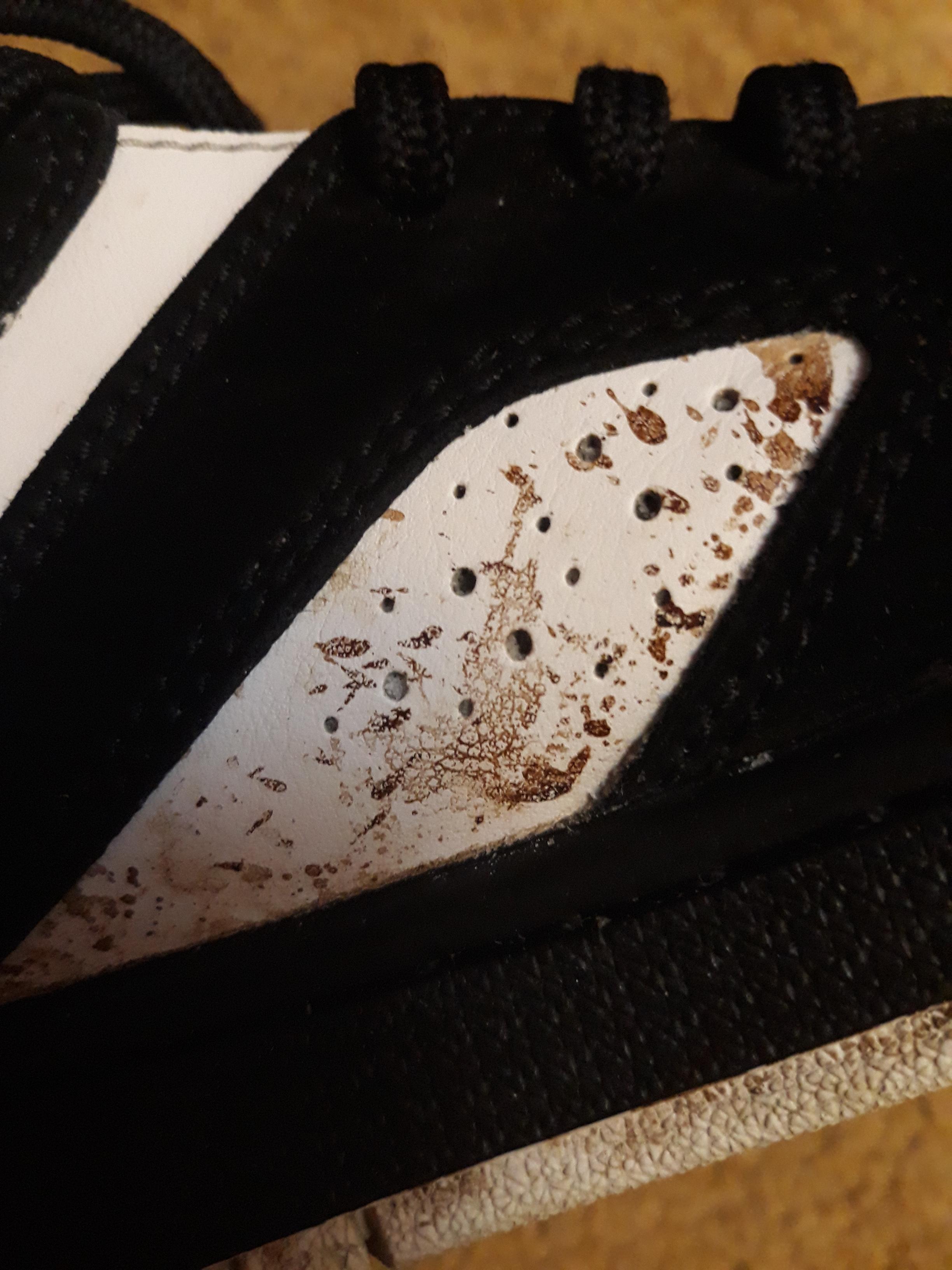 Need help cleaning these stains, have tried baking soda and dish soap