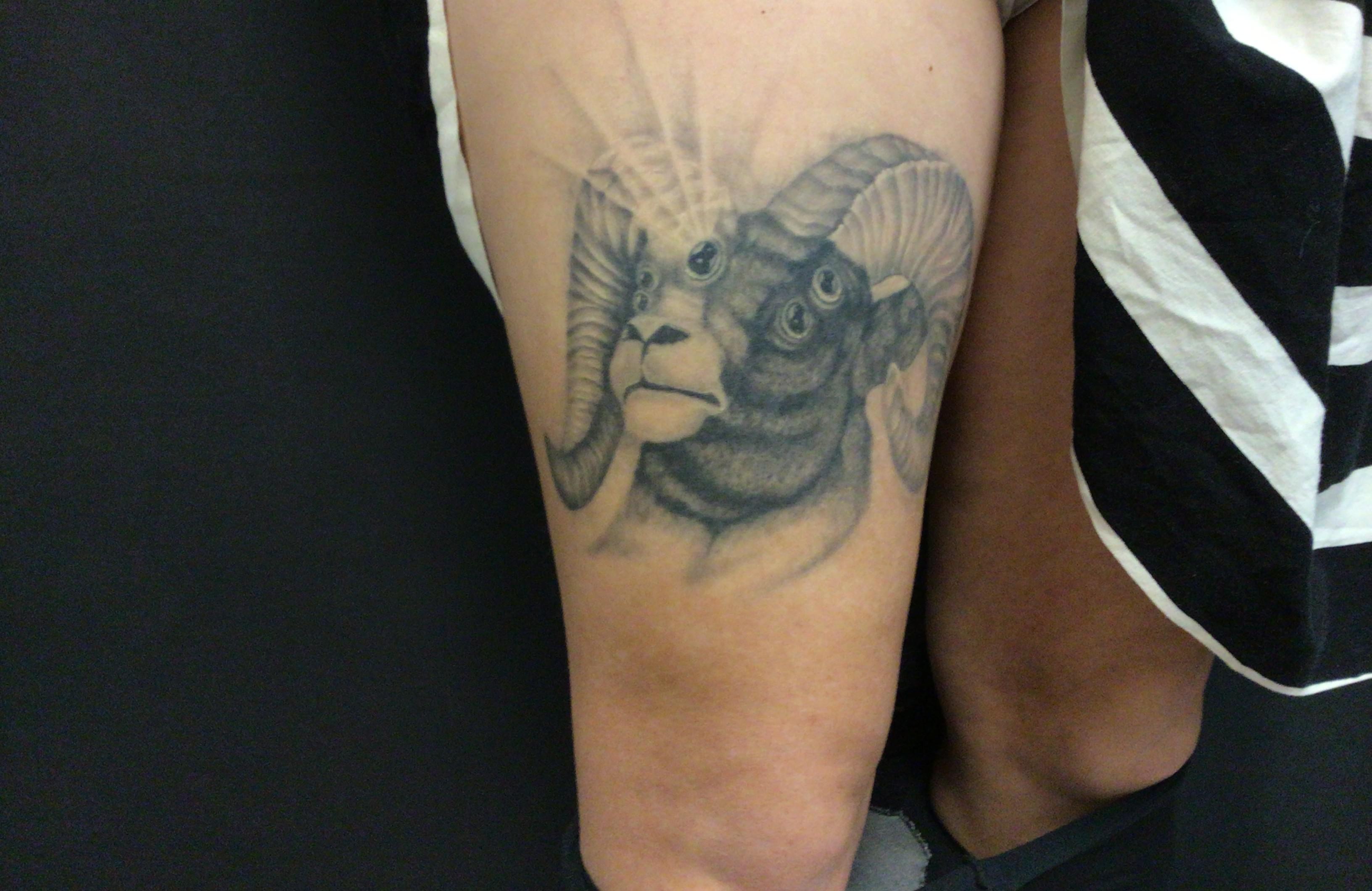 Full sleeve tattoo removal TattooRemoval